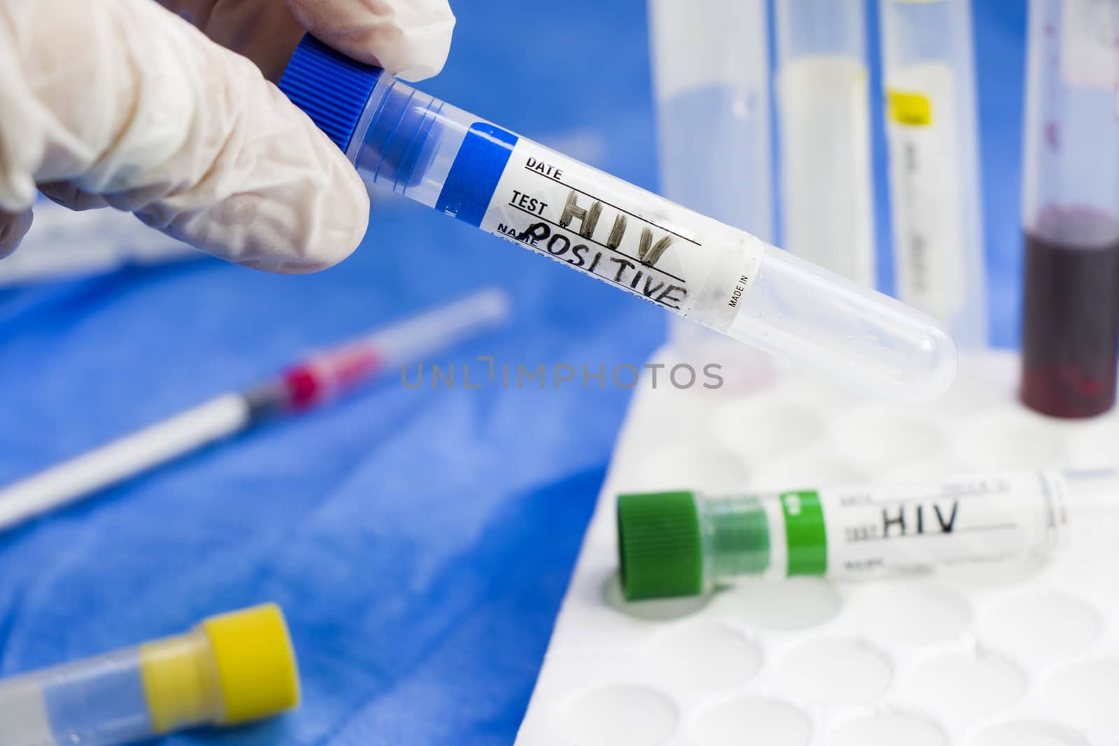 HIV and aids infection test, doctors face and hand holding tube with blood on the blue background. Studio shoot.