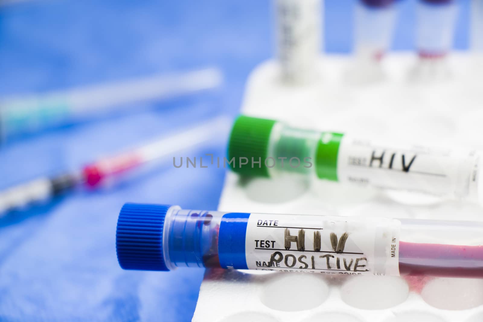 HIV and aids infection test, doctors face and hand holding tube with blood on the blue background. Studio shoot.
