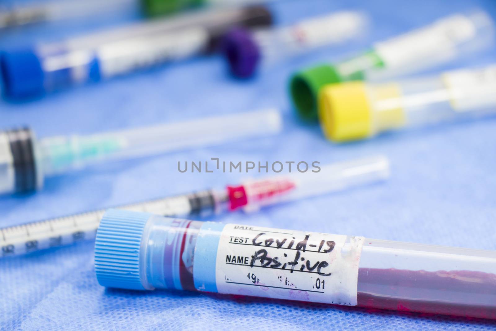 Corona virus and Covid-19 positive test samples. Tubes of blood. by Taidundua