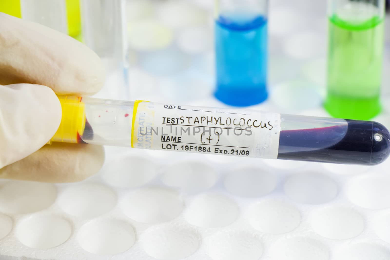 Staphylococci bacteria, blood test tube samples, laboratory and chemical liquid elements, cocci by Taidundua