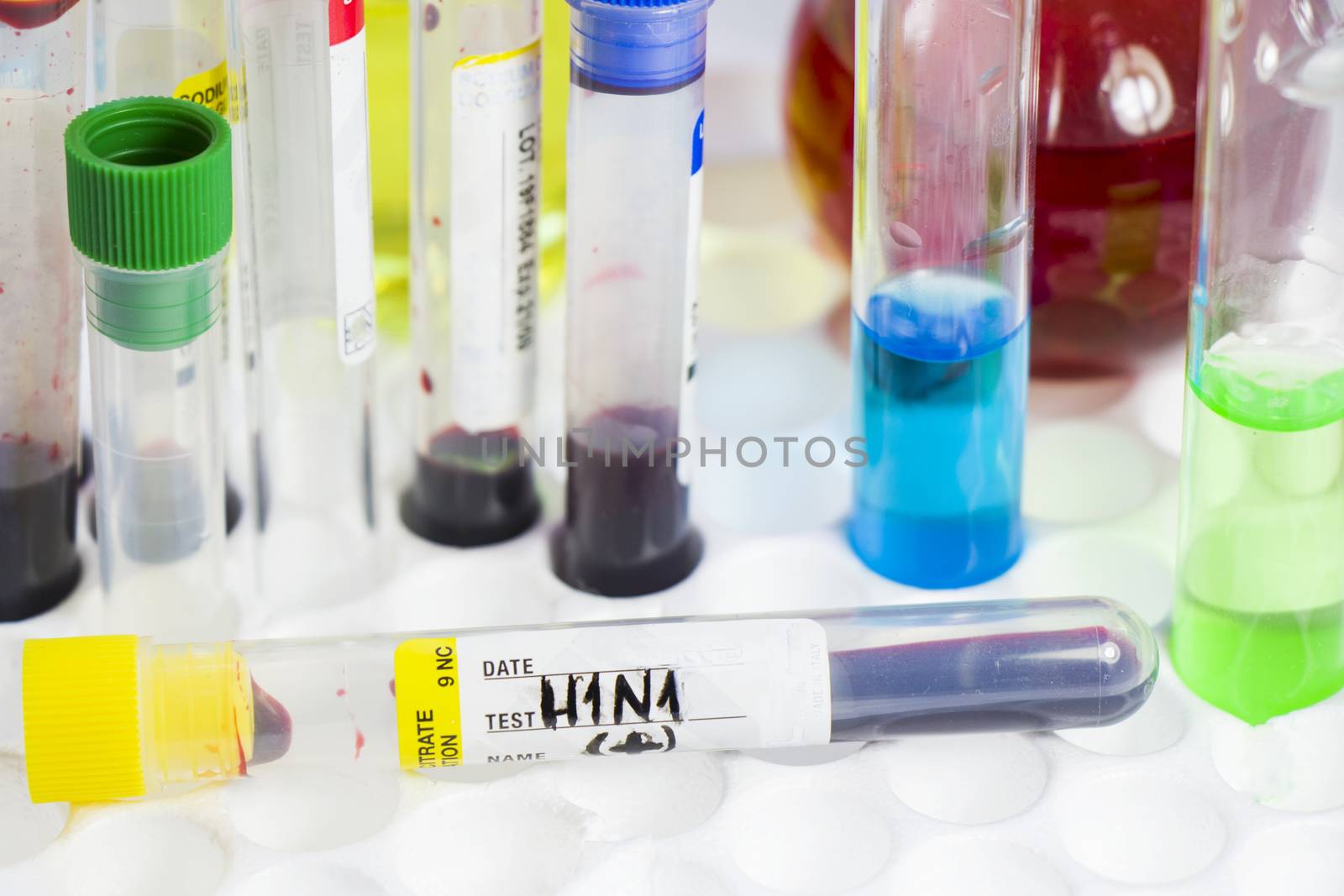 H1N1 swine influenza, diagnoses and lab tests, blood test tube samples, text and letter. by Taidundua