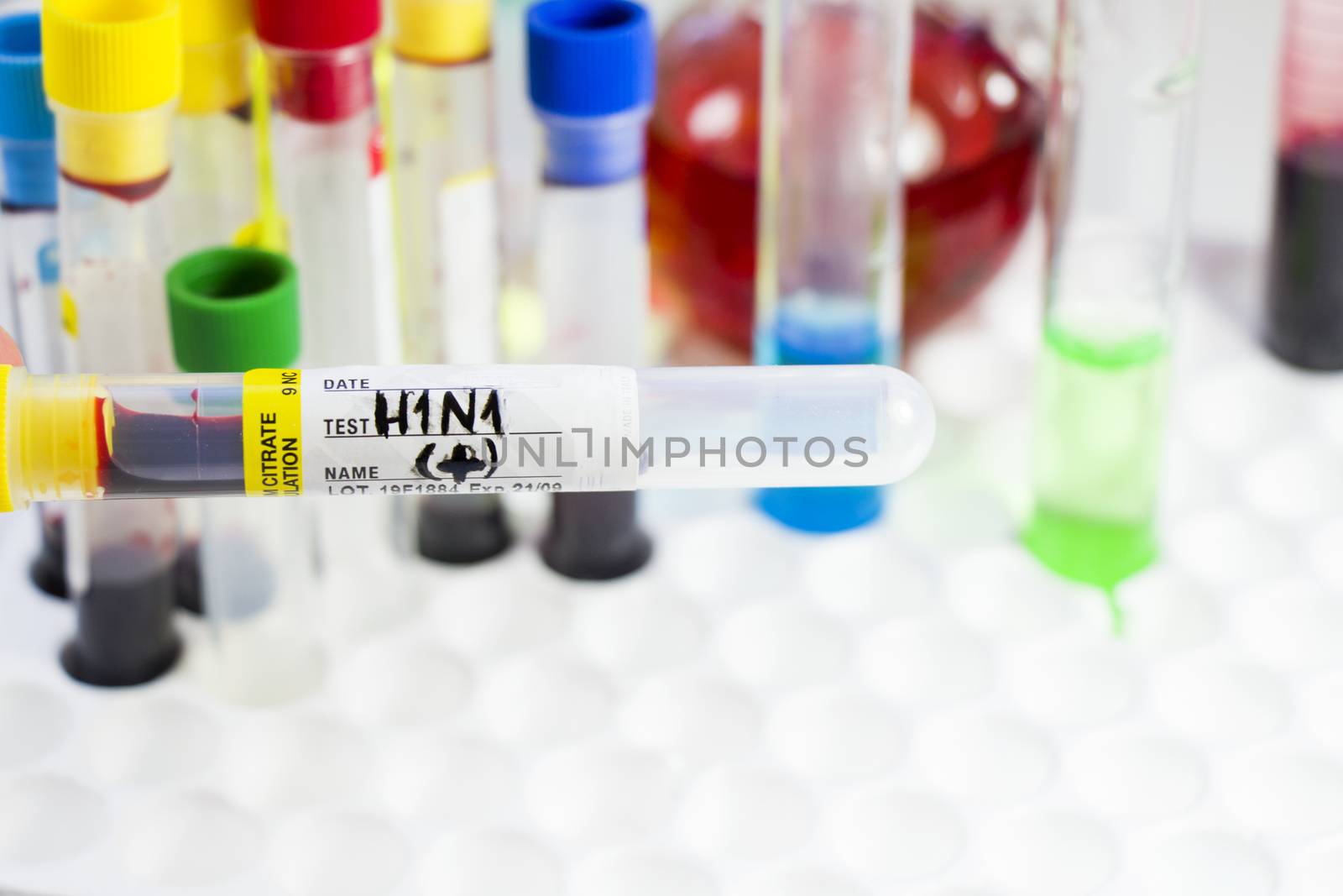 H1N1 swine influenza, diagnoses and lab tests, blood test tube samples, text and letter. Studio shoot on the white background.