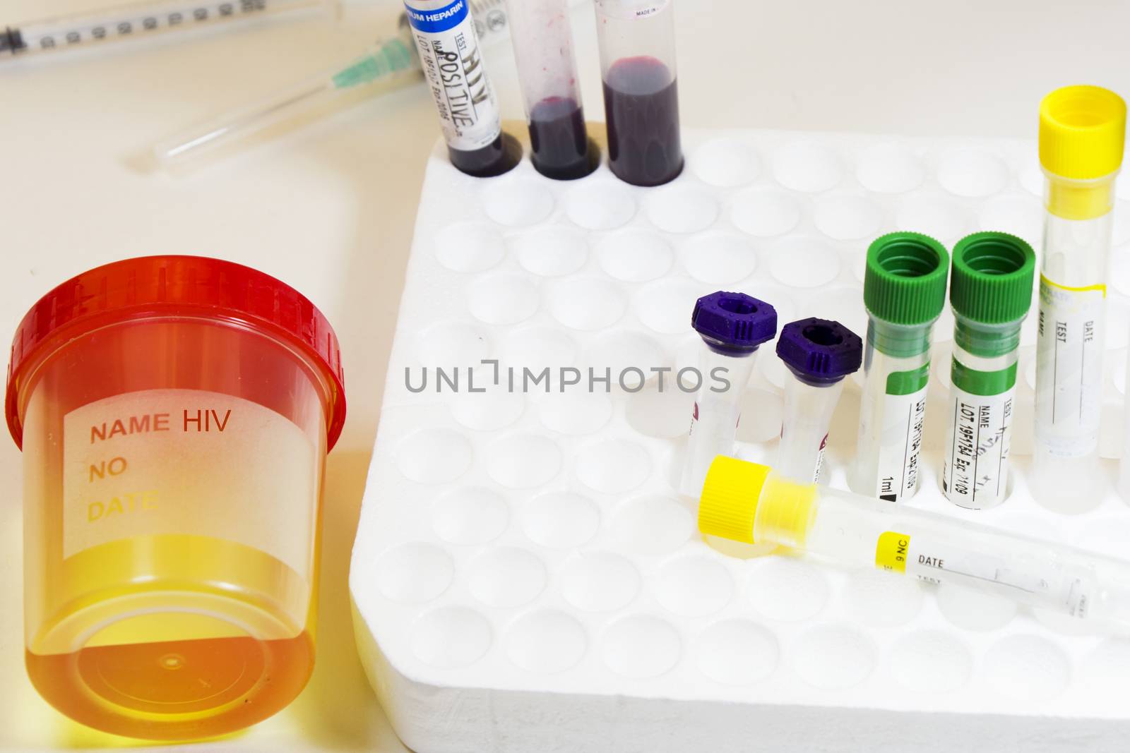 HIV and aids tests, medical urine and pee test with blood and other tubes on the white background, colorful lab test containers, viruses and infection laboratory tests