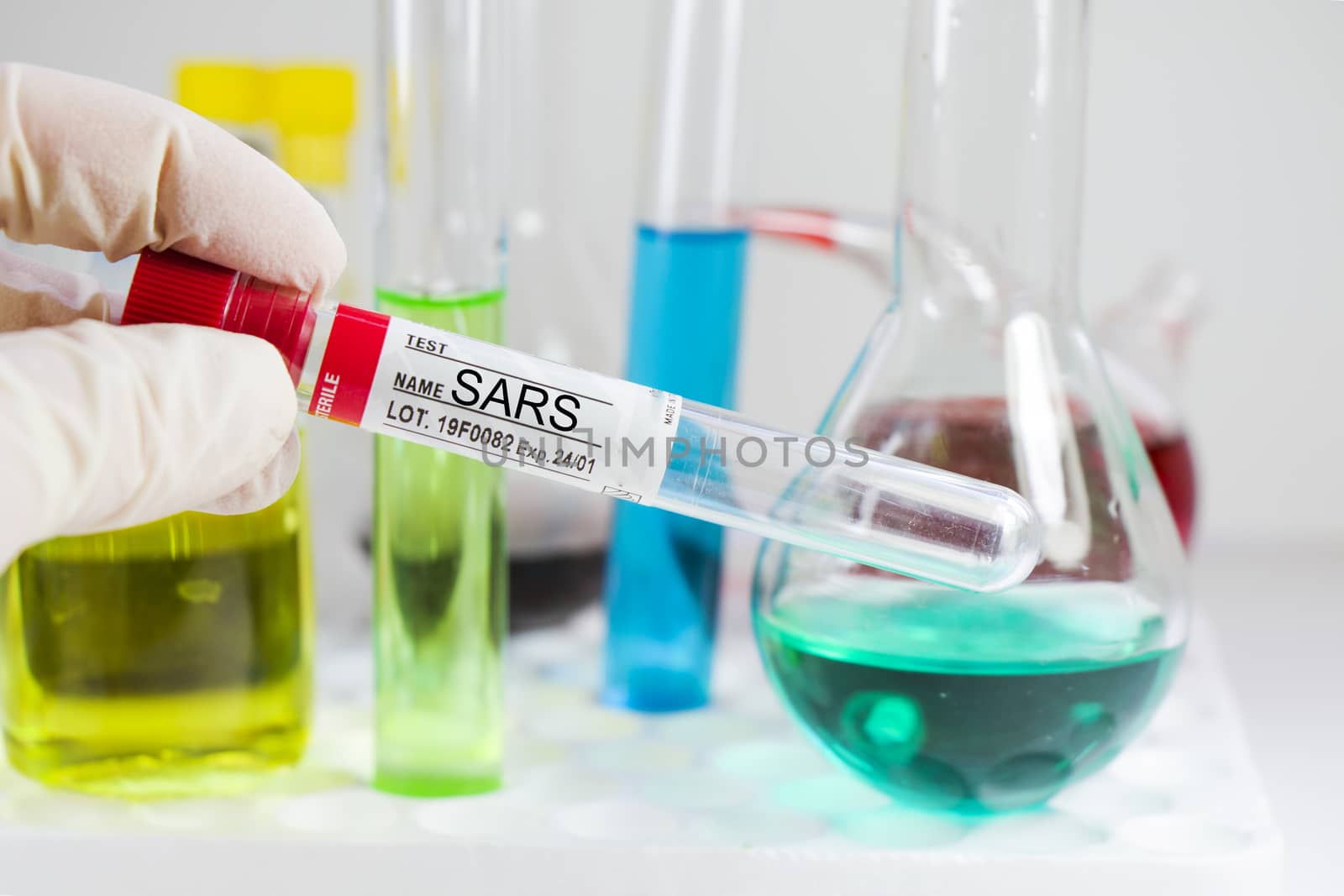Sars viruses blood test tube and chemical elements, laboratory diagnoses, studio shoot on the white background. by Taidundua