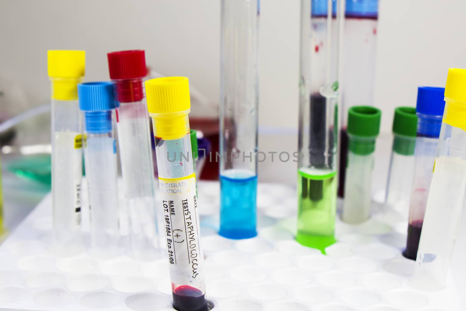 Staphylococci bacteria, blood test tube samples