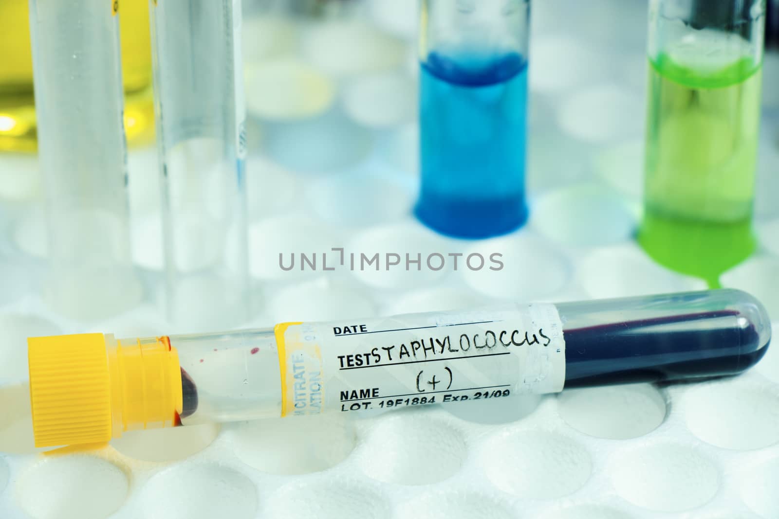 Staphylococci bacteria, blood test tube samples