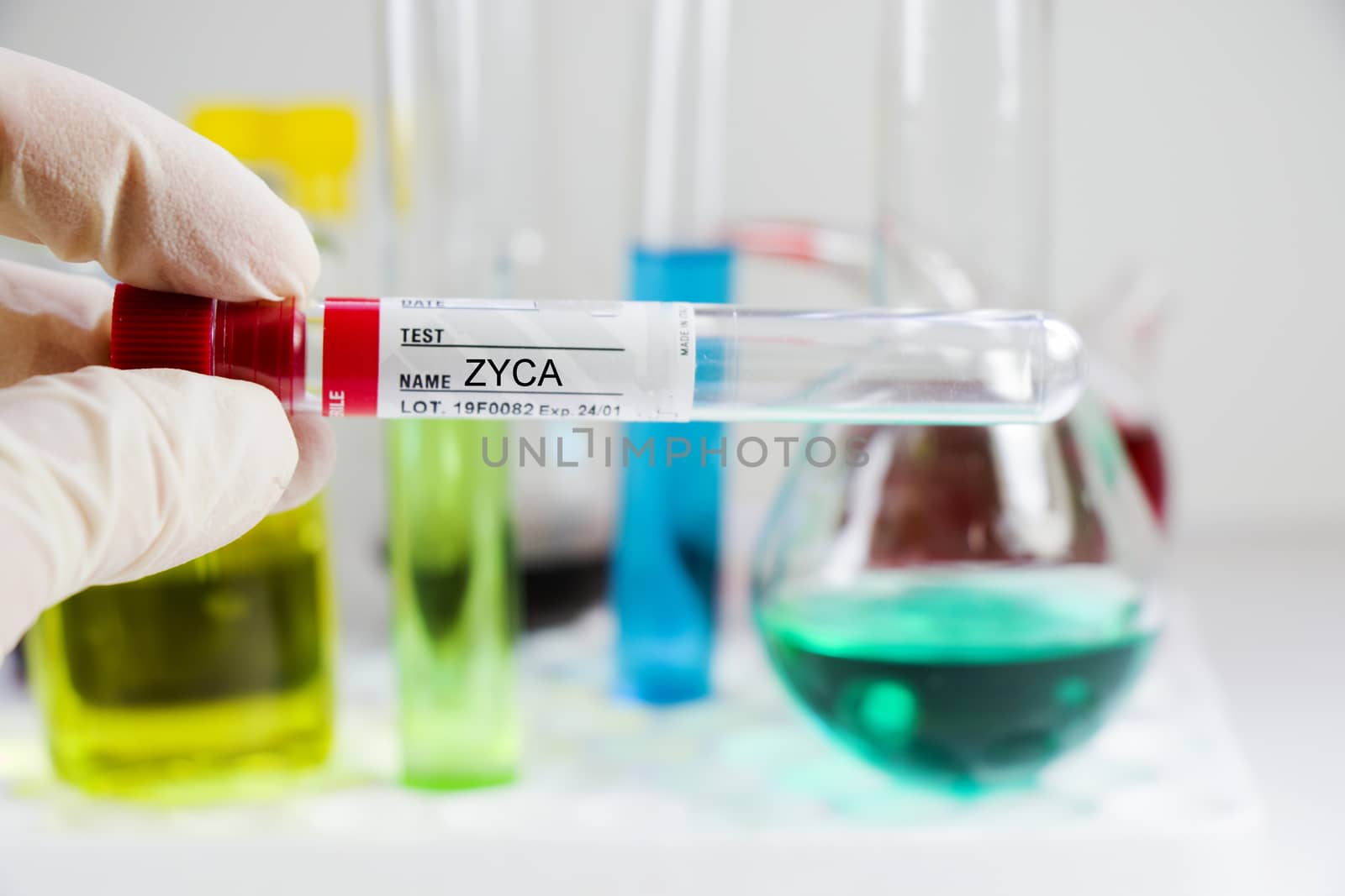 Zyca virus, blood test tube samples, laboratory and chemical liquid elements, cocci by Taidundua