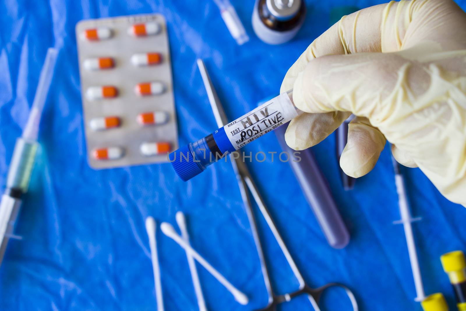 HIV blood test tube sample, aids immune viruses.
