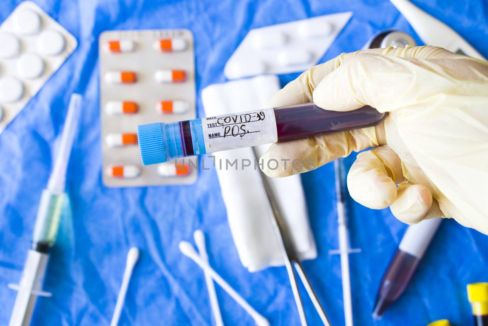Corona virus negative blood test tubes on the white background, studio shoot. Blood test samples. Diagnosis and laboratory.
