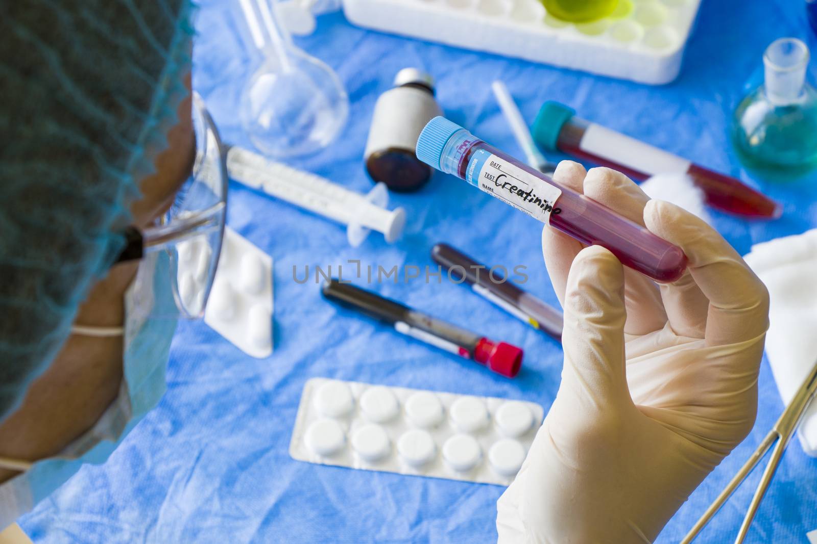 Creatinine blood test tube sample in doctors hand in laboratory by Taidundua