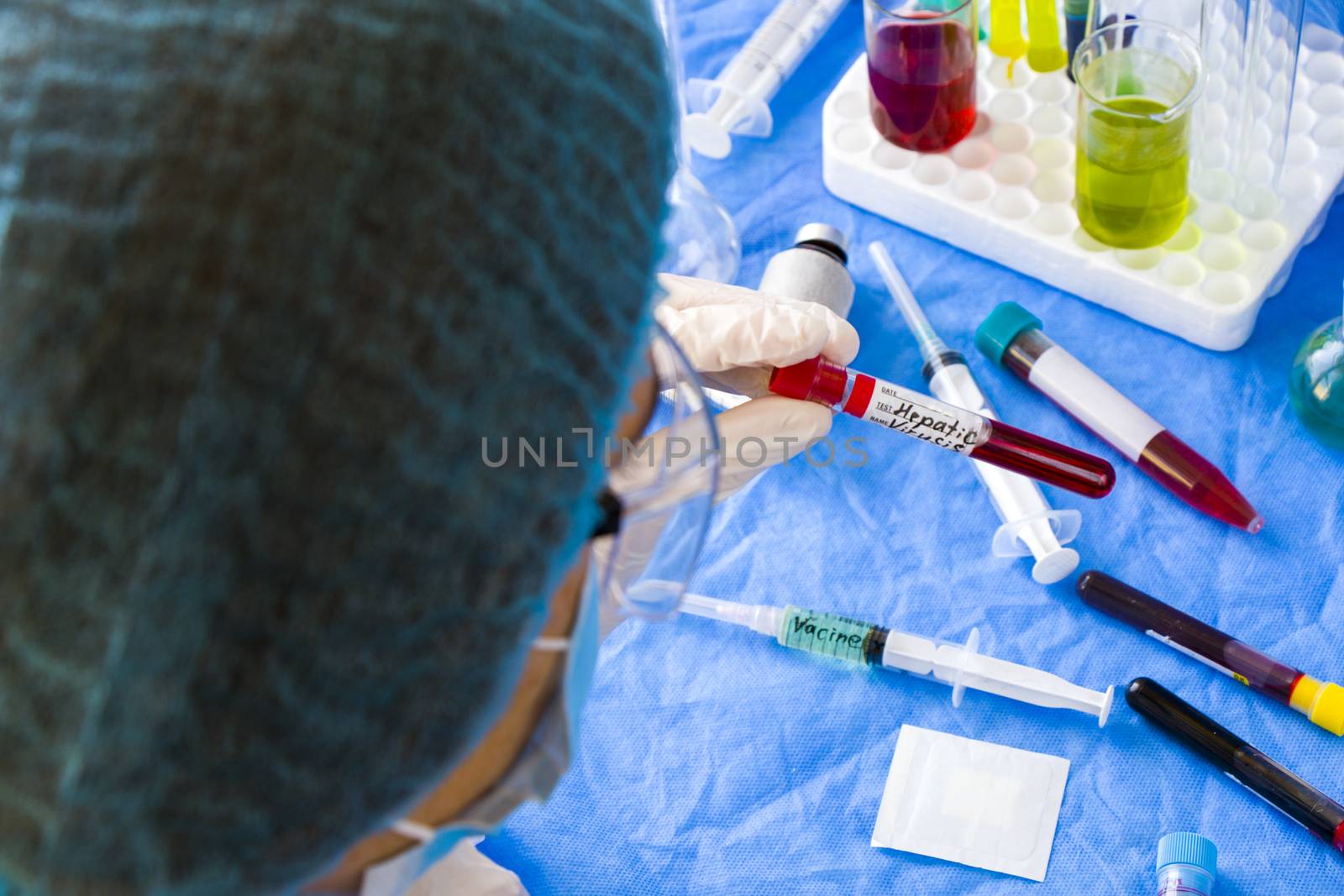 Hepatic blood test tube sample in doctors hand, doctors head with mask and glasses