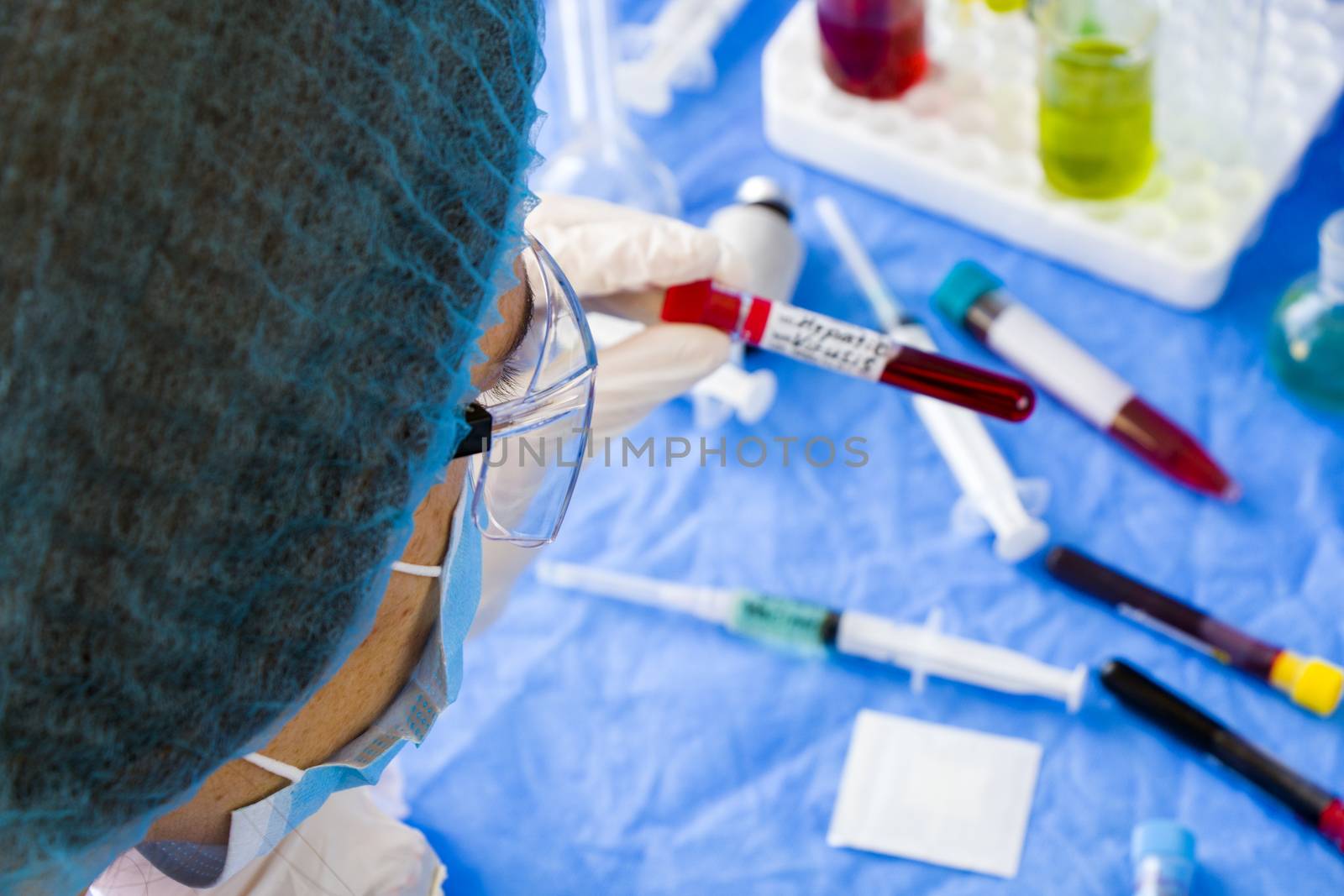 Hepatic blood test tube sample in doctors hand, doctors head with mask and glasses