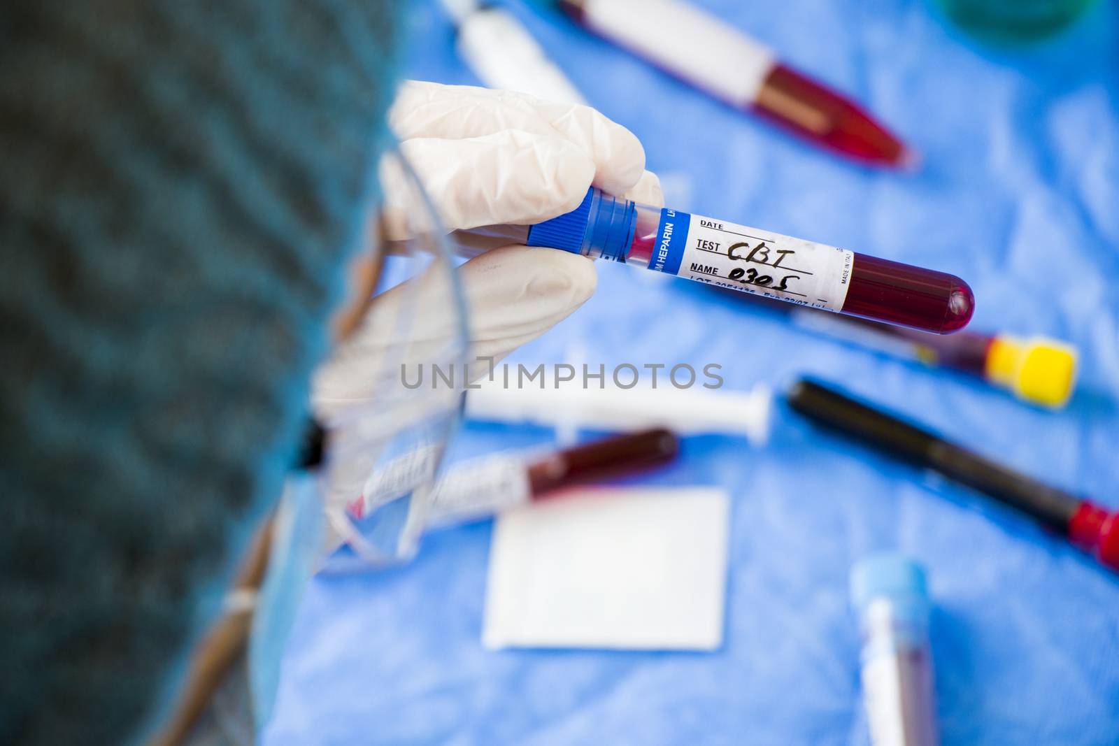 CBC blood test tube sample in doctors hand by Taidundua