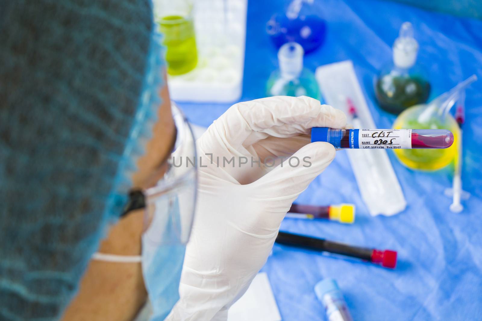 CBC blood test tube sample in doctors hand by Taidundua