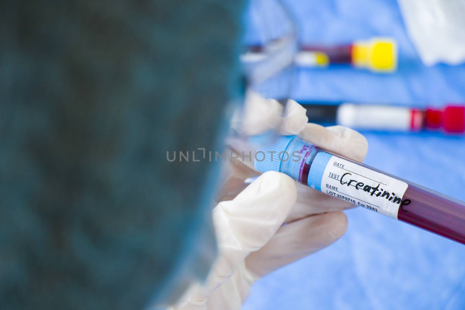 Creatinine blood test tube sample in doctors hand in laboratory, doctors face