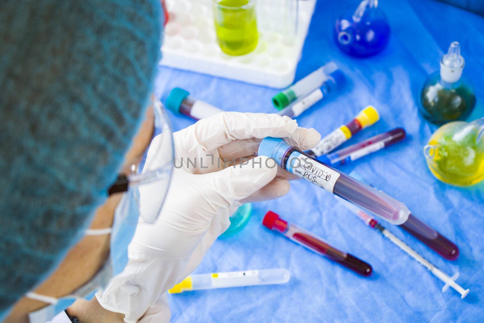 Corona virus positive test samples. Diagnosis and laboratory. Doctors head and hand with glove. Studio shoot, white background.