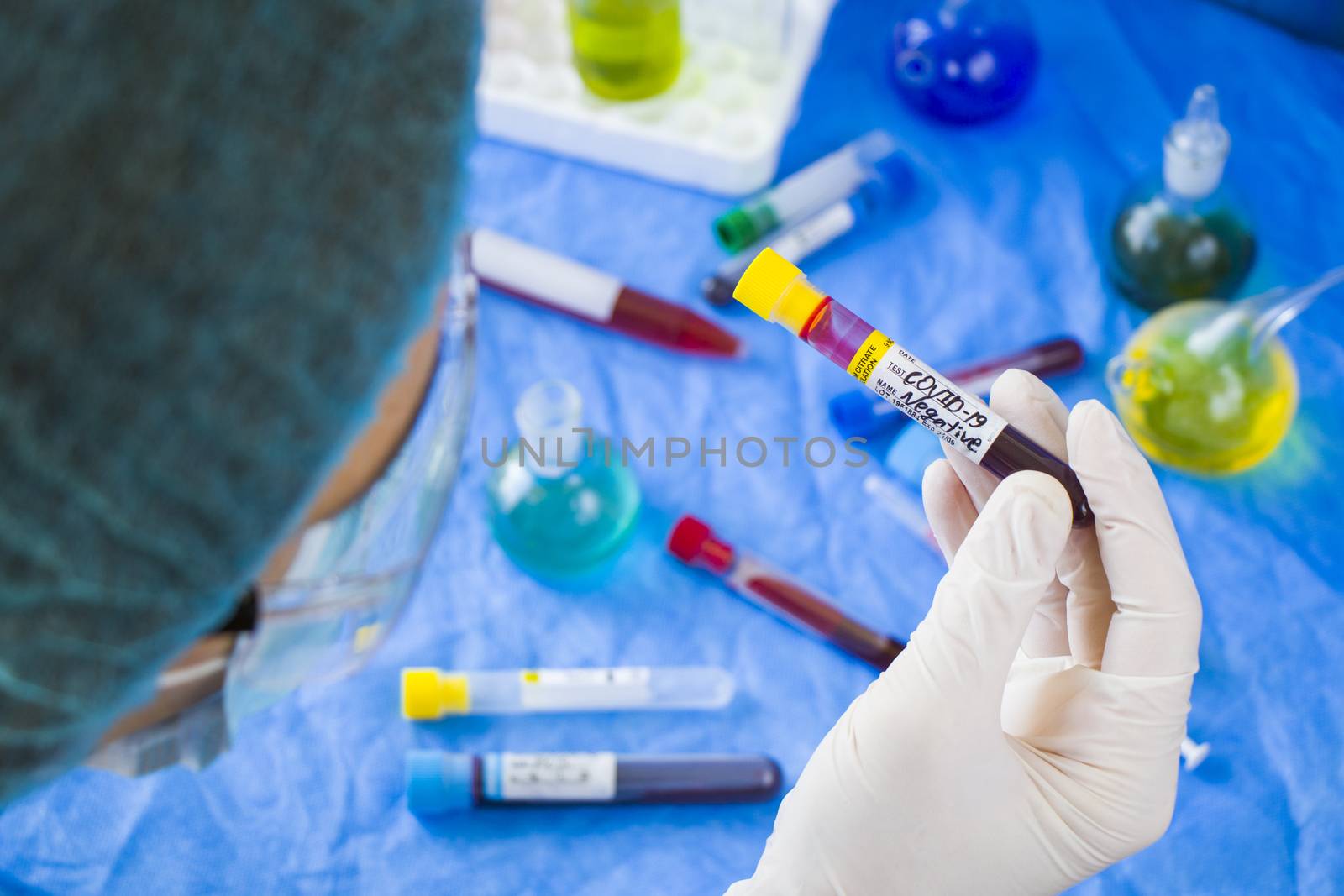 Corona virus negative test samples. Diagnosis and laboratory. Doctors head and hand with glove. Studio shoot, white background.