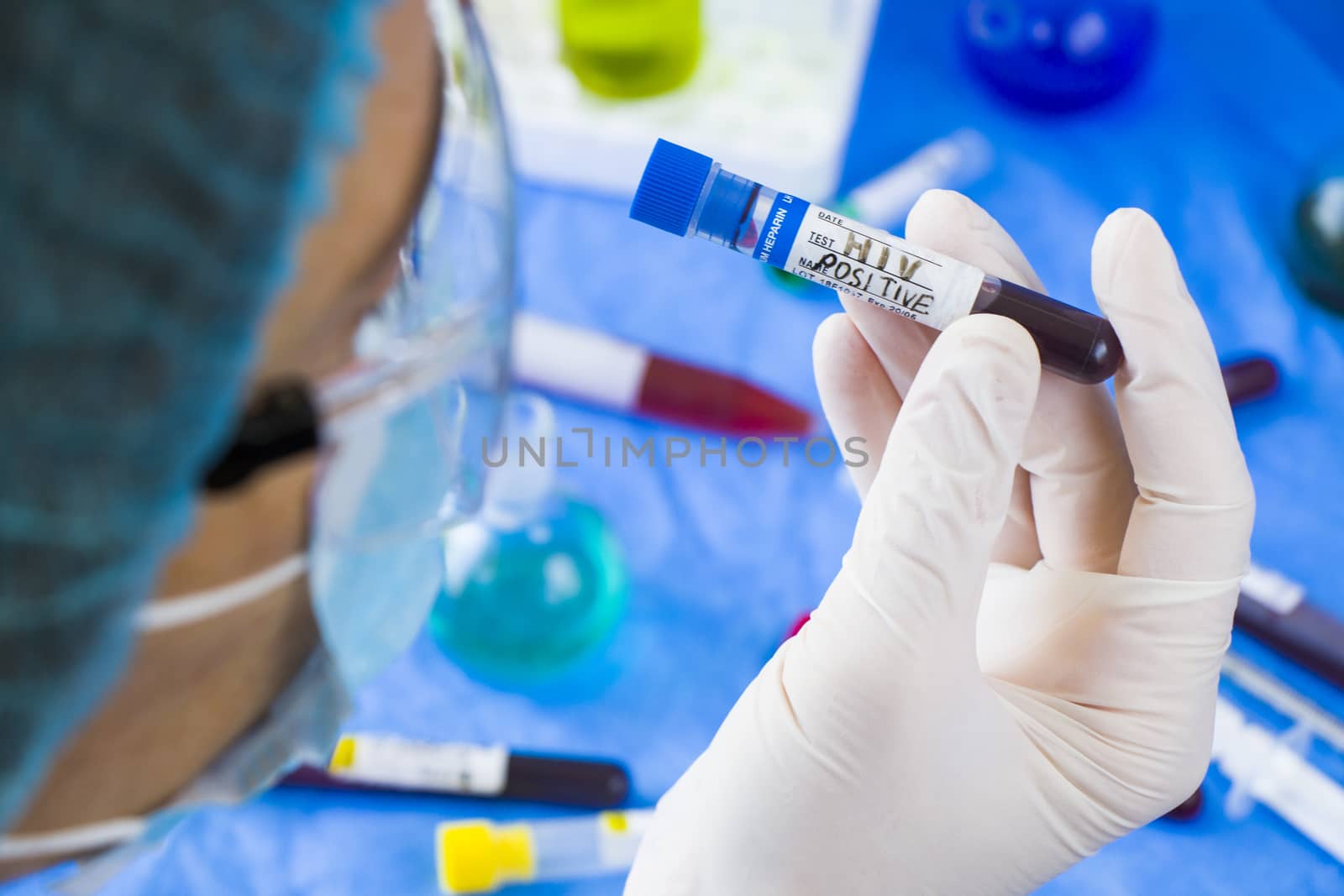 HIV and aids infection test, doctors face and hand holding tube with blood on the blue background. Studio shoot.