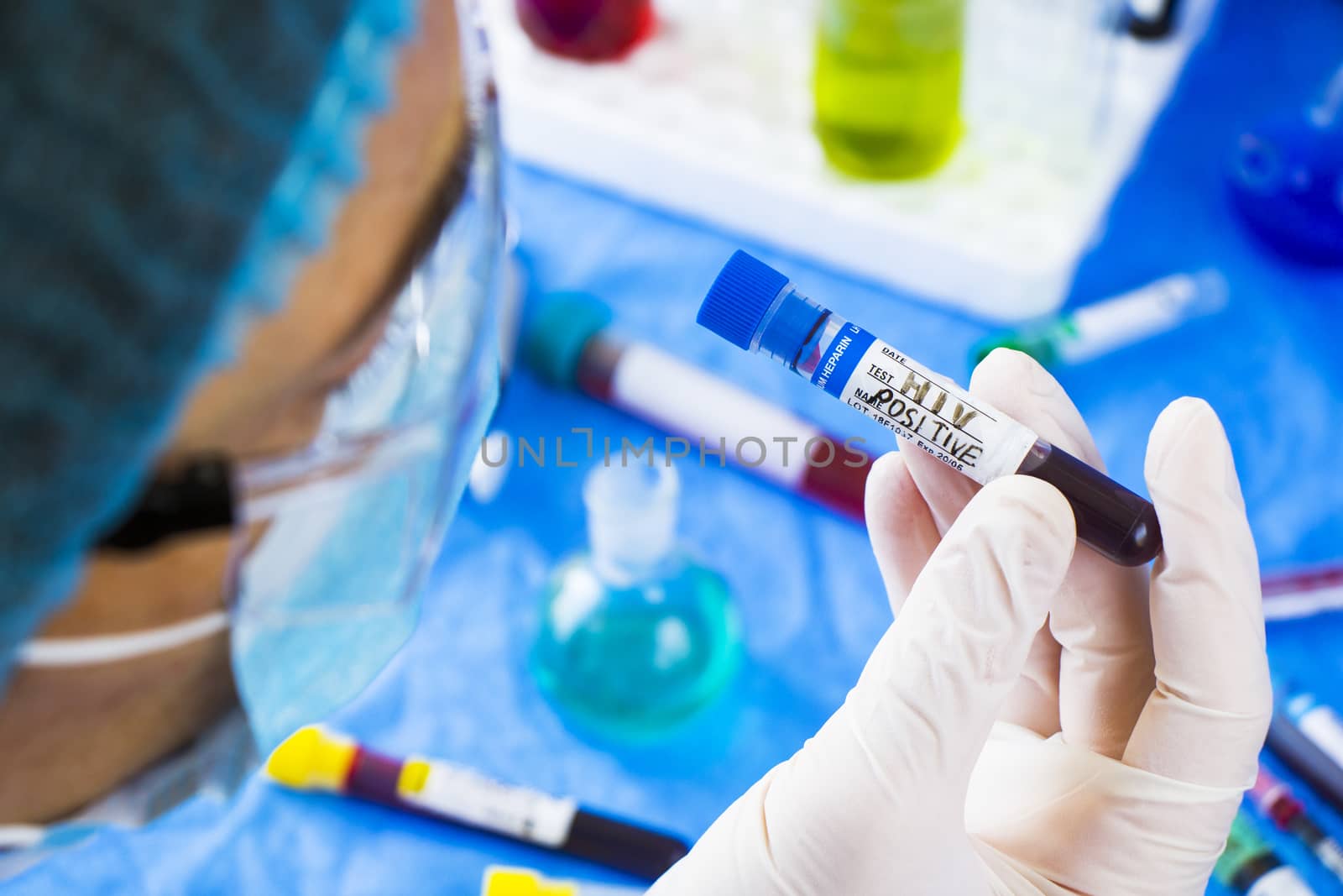 HIV and aids infection test, doctors face and hand holding tube with blood on the blue background. Studio shoot.