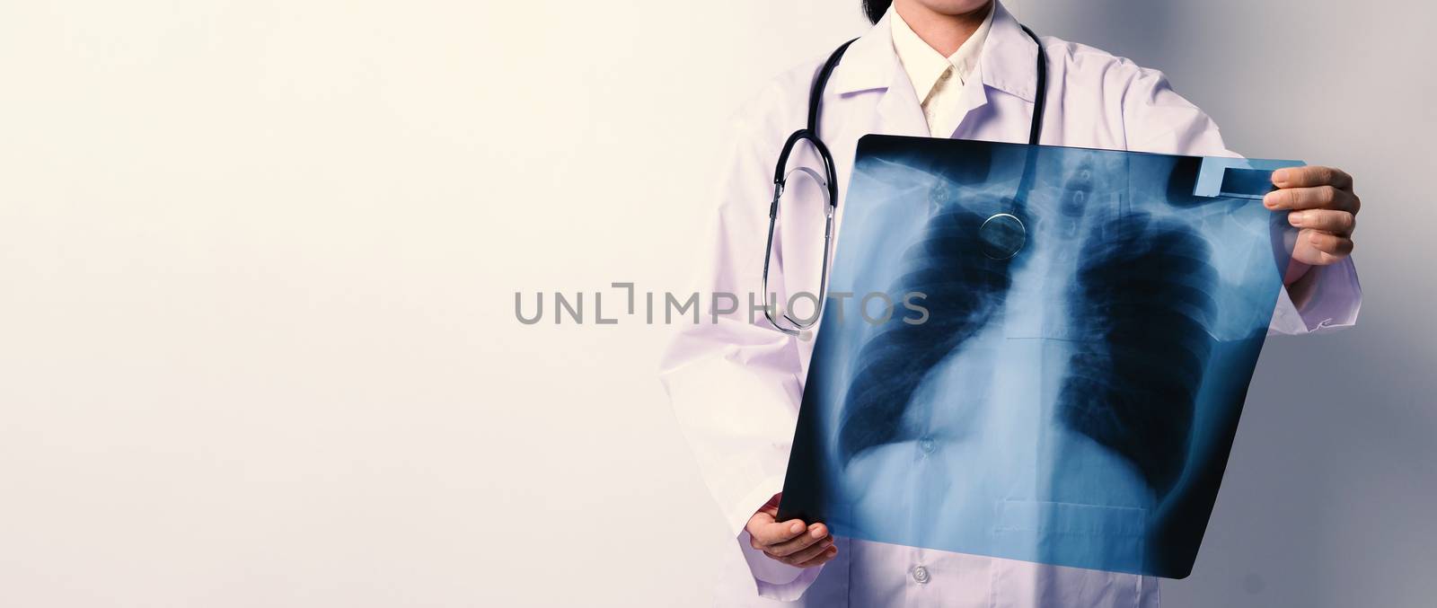 Middle aged of asian woman doctor standing and holding a x-ray f by gnepphoto