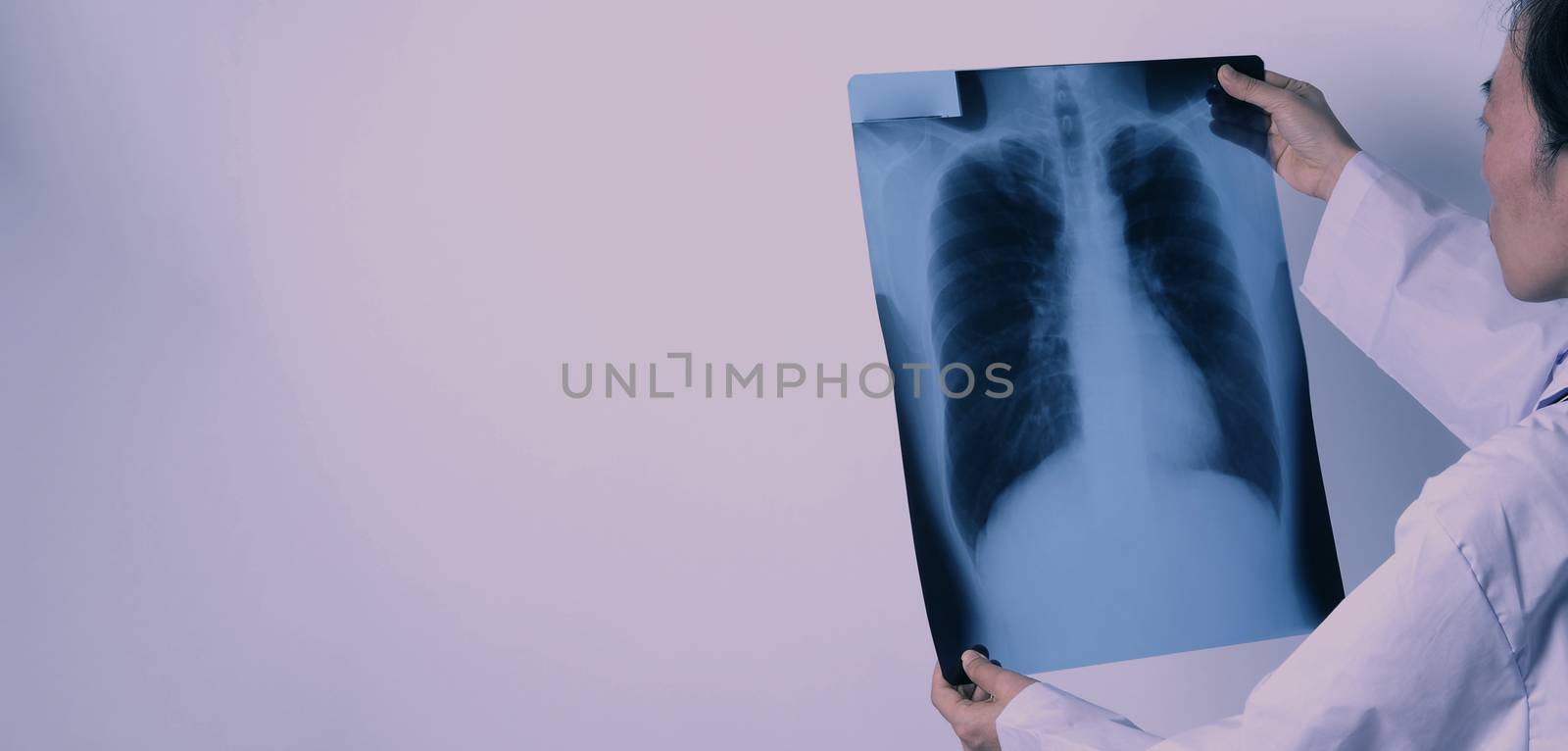 Middle aged of asian woman doctor standing and holding a x-ray f by gnepphoto