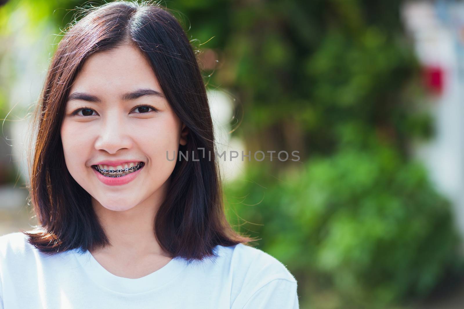 Portrait of Asian teen beautiful young woman smile have dental braces on teeth laughing outdoor, Medicine and dentistry concept