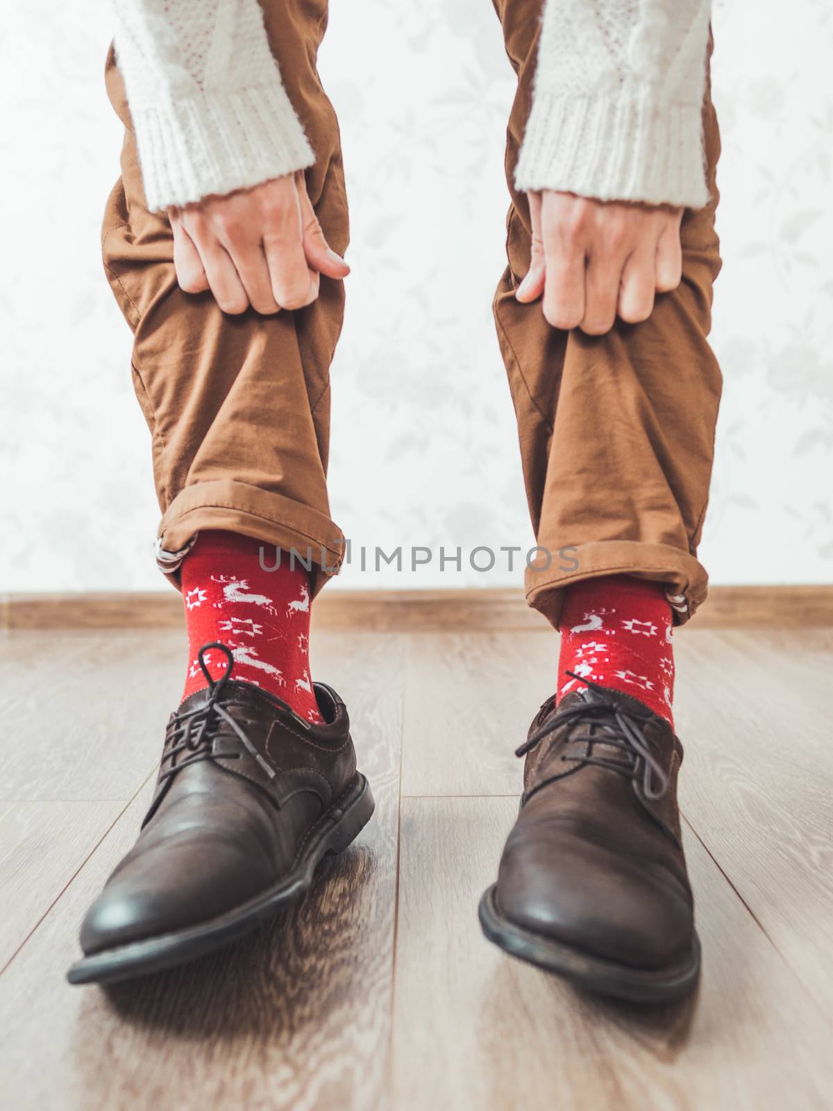 Young man pulls up leg of his chinos trousers to show bright red by aksenovko