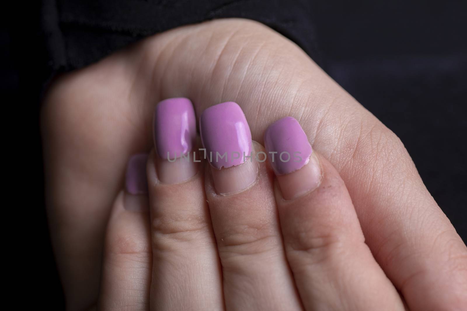 Overgrown manicure. Female hands with overgrown nails. Time for correction gel polish. nail care concept stock photo