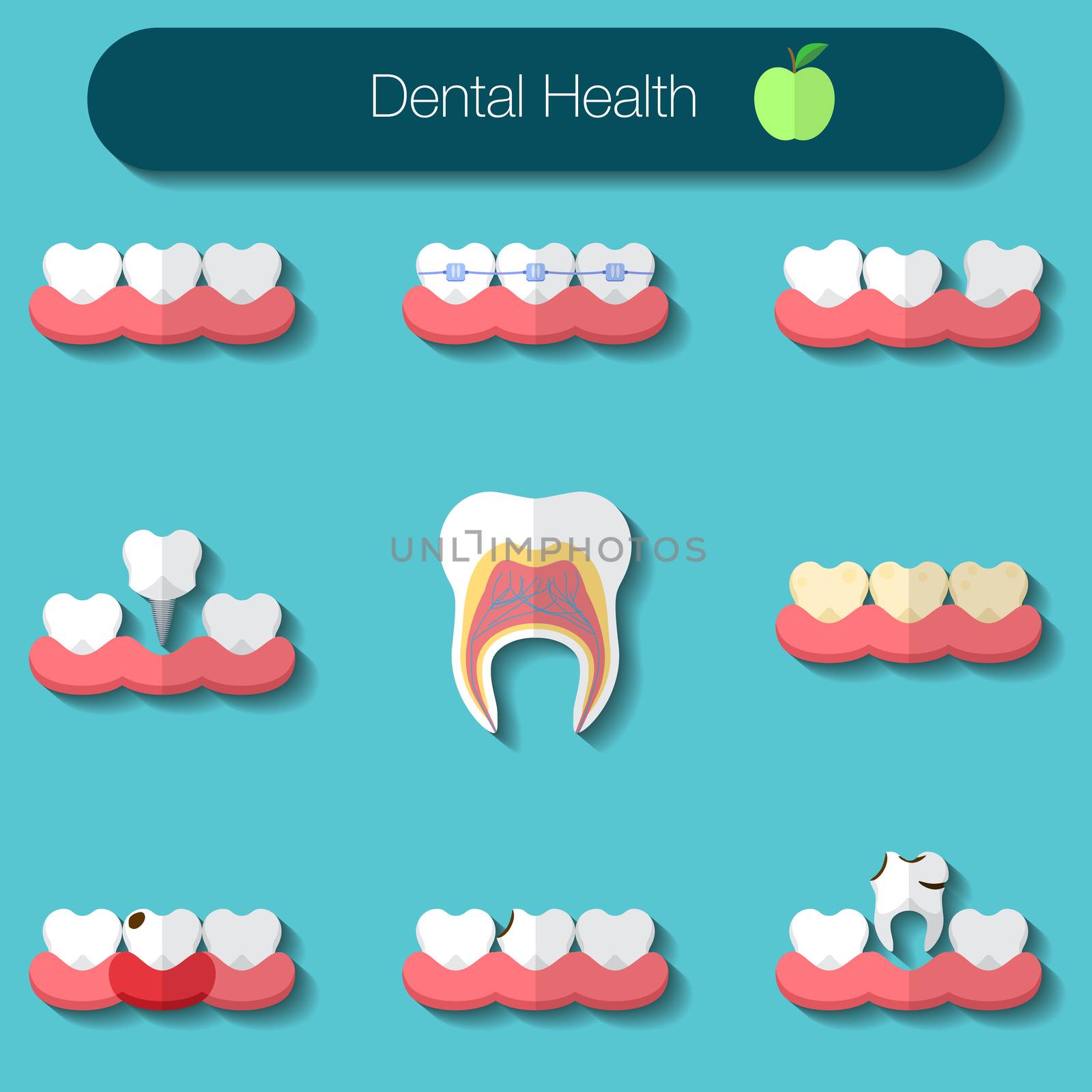 Dental care flat design Vector illustration of heathy theeth, caries, braces system, implantation, and other dental health icons set by Lemon_workshop