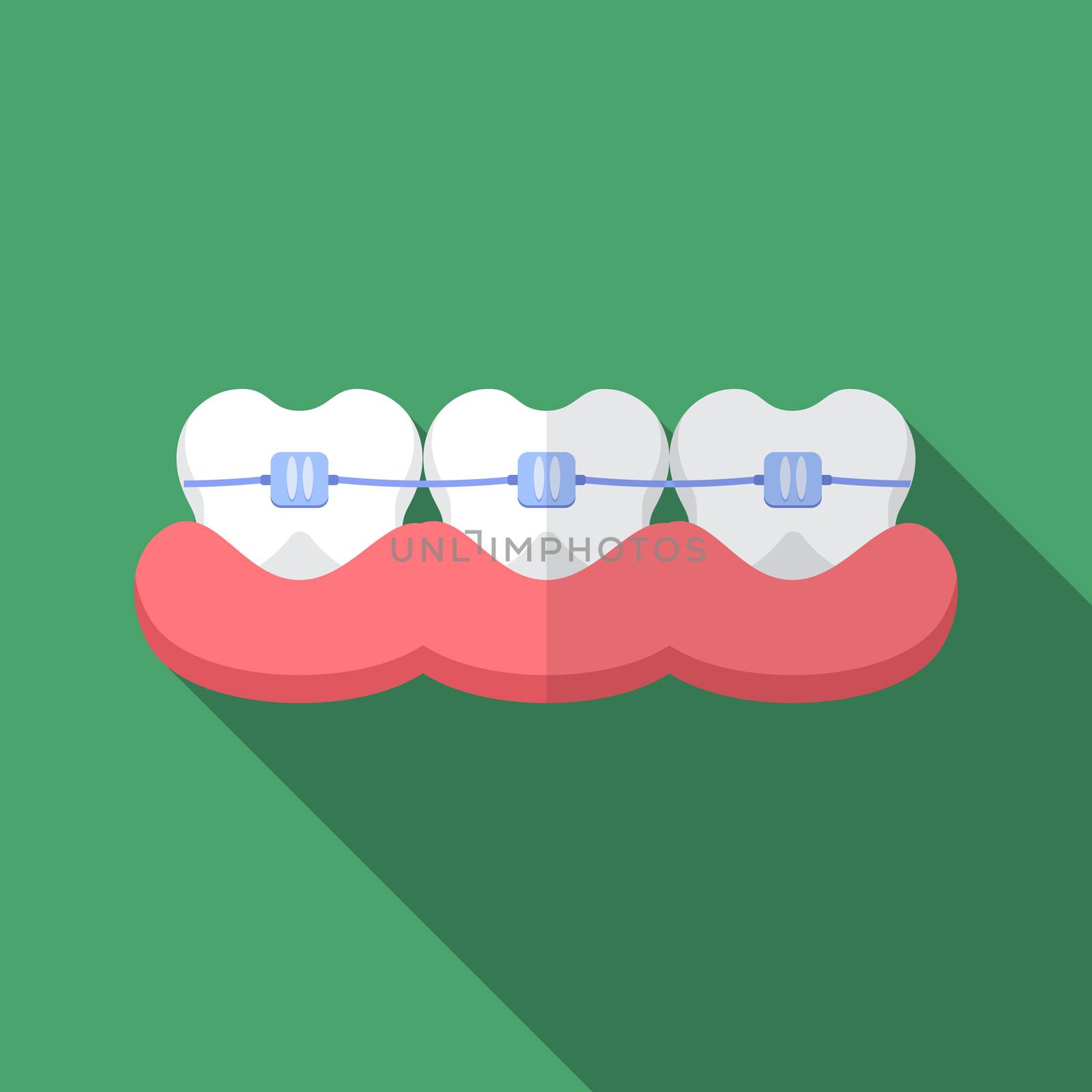 Flat design modern vector illustration of dental bracers icon with long shadow.