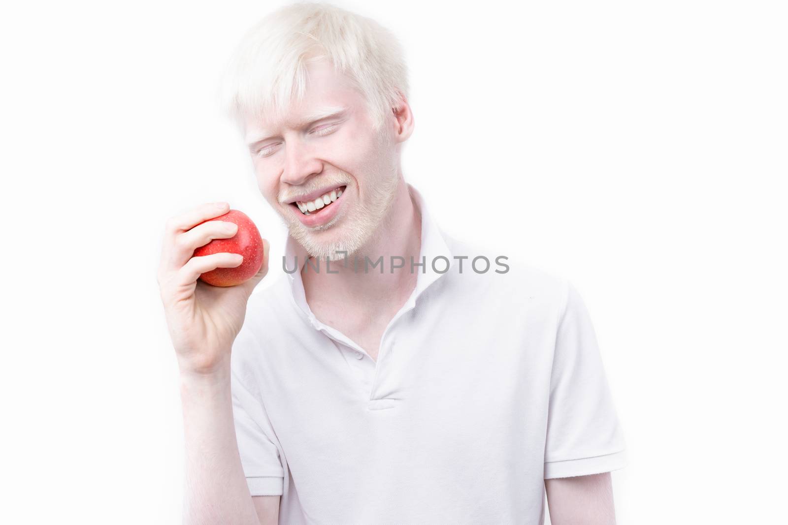 albinism albino man white skin hair studio dressed t-shirt isolated white background. abnormal deviations. unusual appearance. skin abnormality Beautiful people with special appearance. Eat red apple