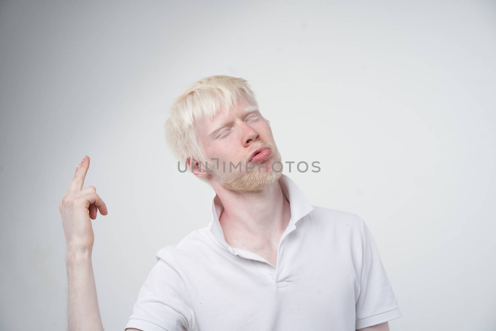Sad albino man white skin hair studio dressed t-shirt isolated white background. abnormal deviations. unusual appearance. skin abnormality Beautiful people with special appearance.