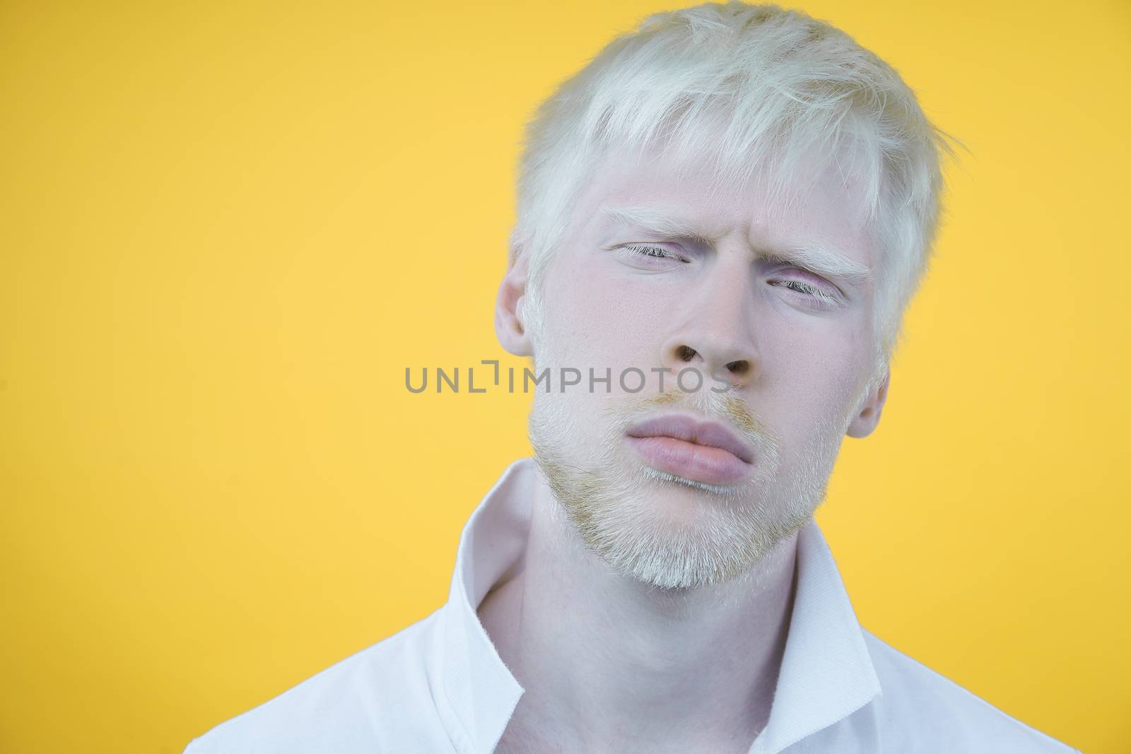 albinism Sad albino man white skin hair studio dressed t-shirt isolated yellow background. abnormal deviations. unusual appearance. skin abnormality Beautiful people with special appearance.