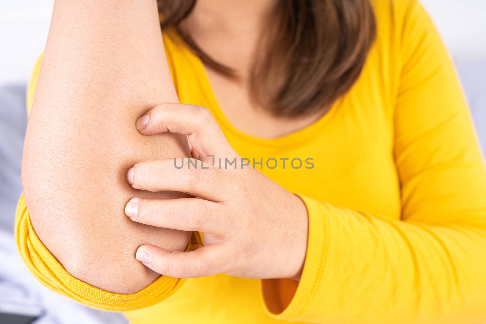 Female scratching her arm on white background with copy space. Medical, healthcare for advertising concept.