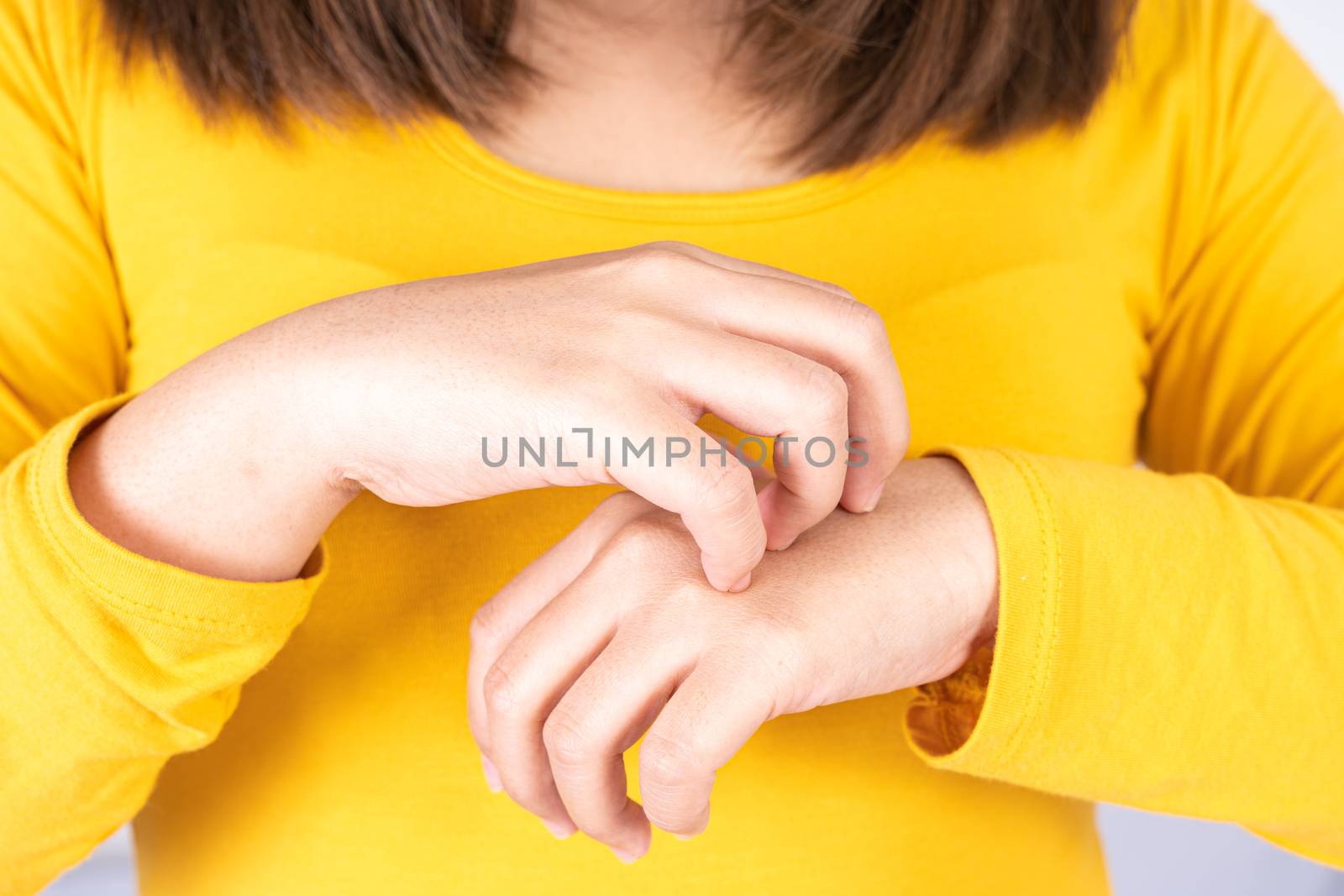 Female scratching her hand on white background with copy space. Medical, healthcare for advertising concept.