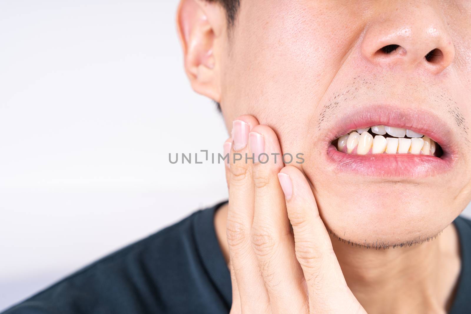 Man suffering from toothache, hand touching wisdom tooth. Dental, healthcare concept by mikesaran