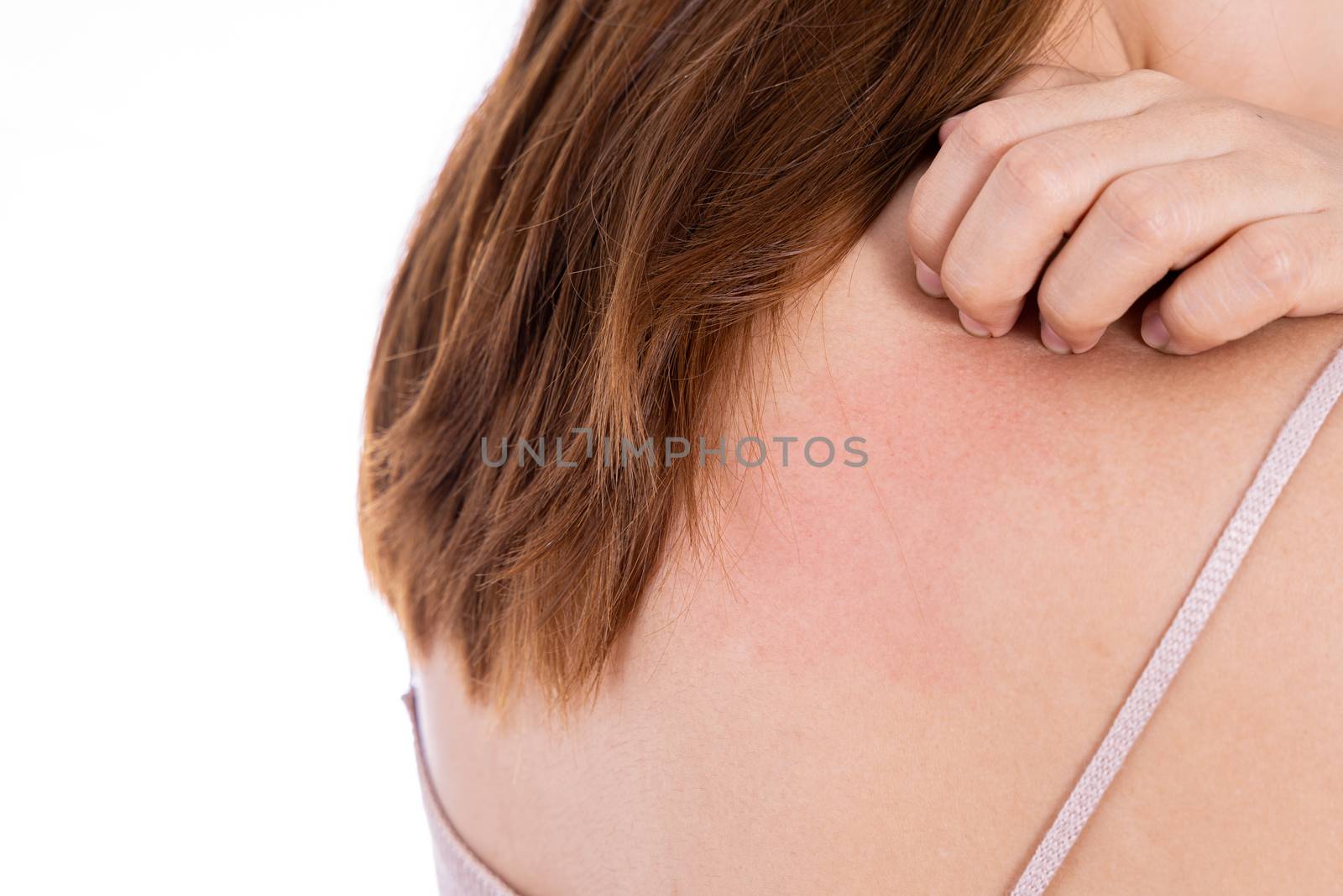 Female scratching her back isolated white background. Medical, healthcare for advertising concept.