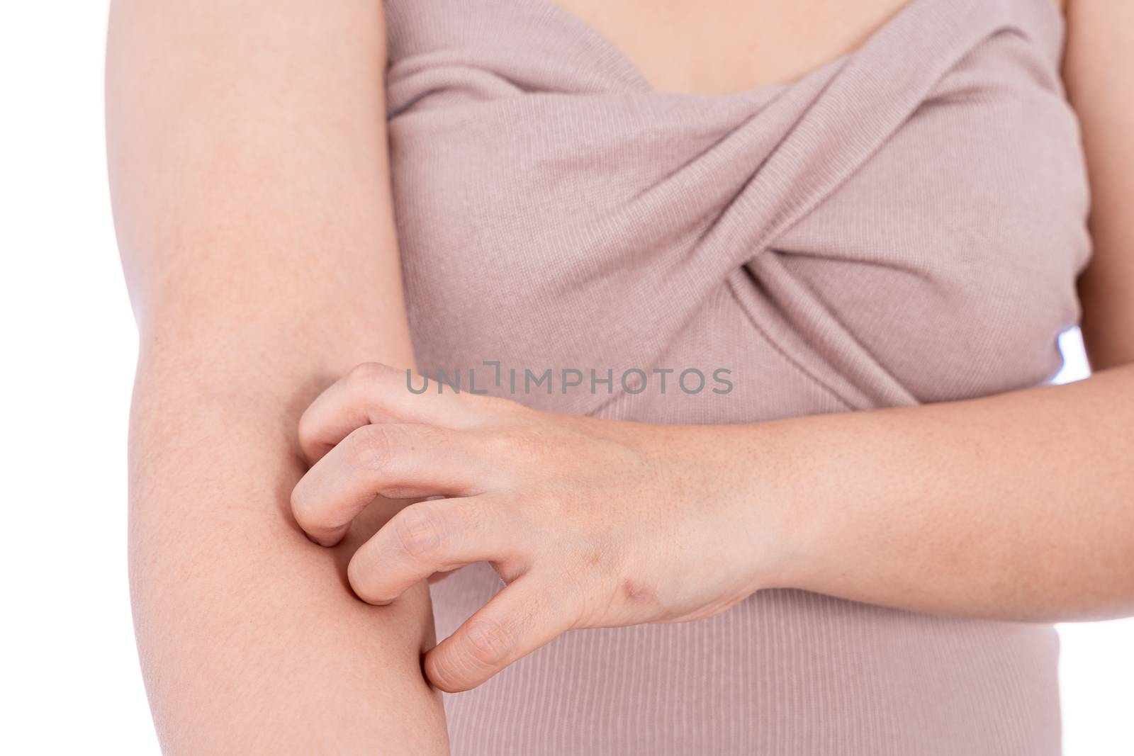 Female scratching her arm isolated white background. Medical, healthcare for advertising concept.