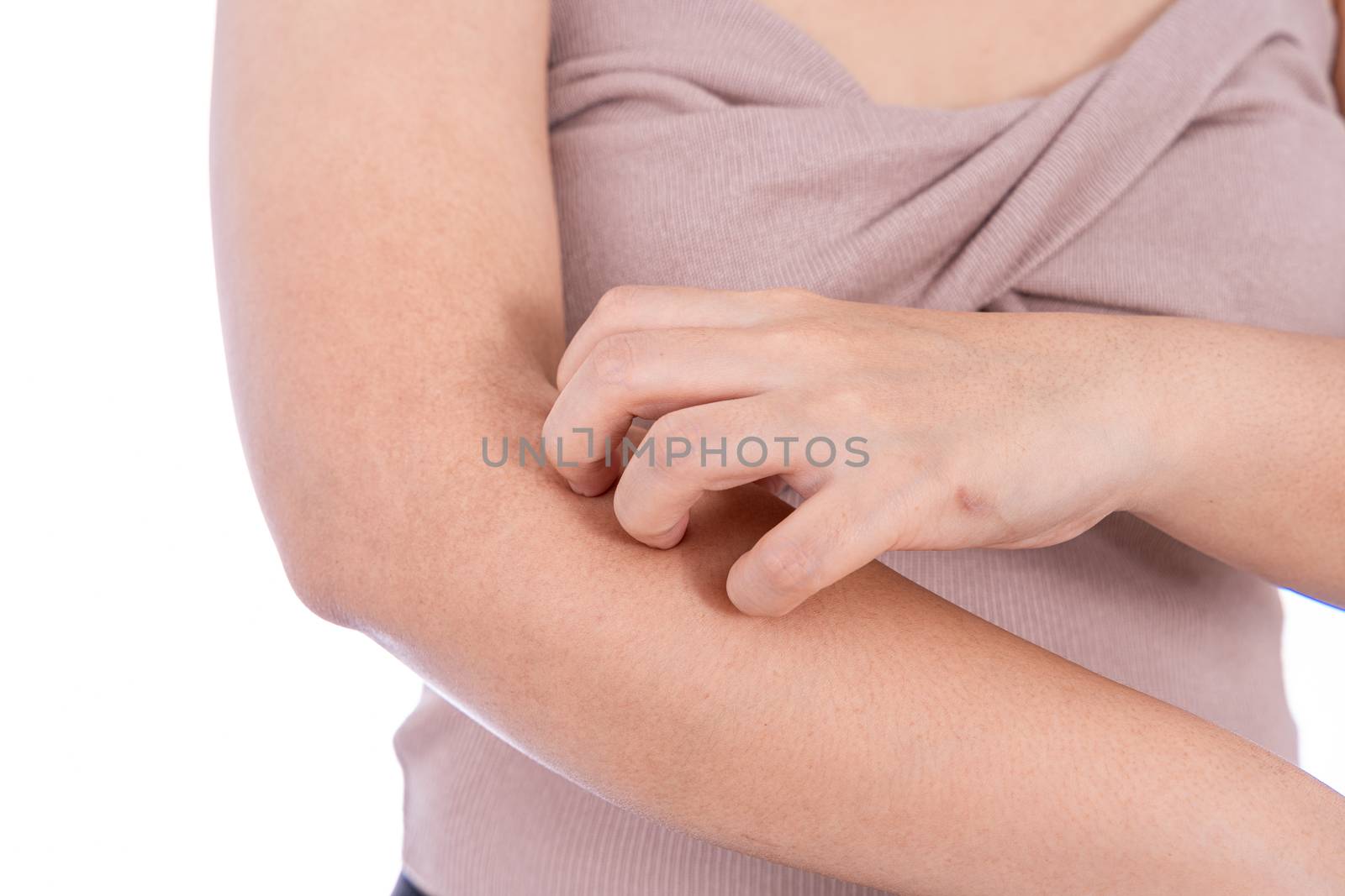 Female scratching her arm isolated white background. Medical, healthcare for advertising concept.