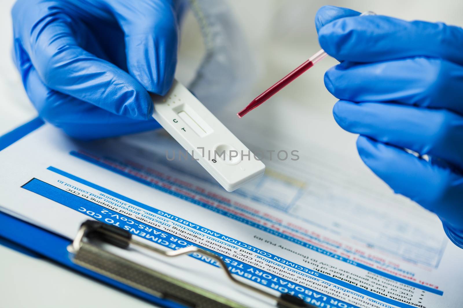 Lab scientist performing rapid diagnostic test RDT for antibodies to detect presence of viral protein antigens expressed by COVID-19 corona virus disease,CDC quick fast antibody point of care testing