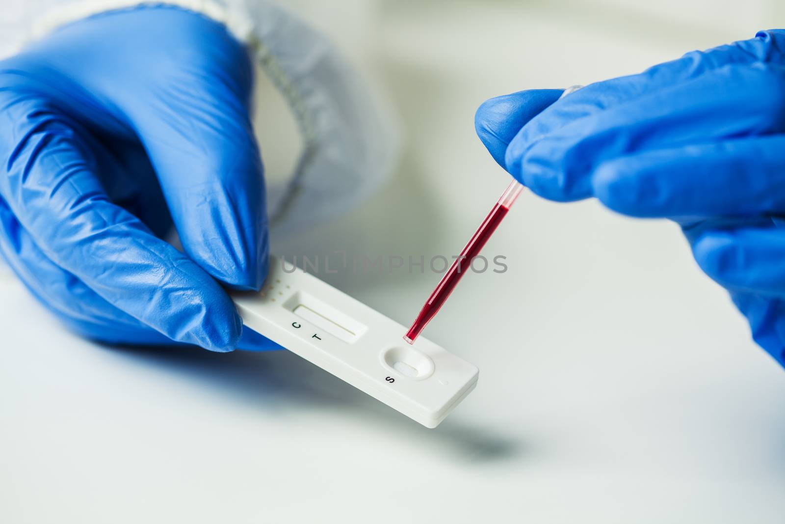 Scientist or doctor placing blood sample on Rapid Diagnostic Rest RDT cassette,medical technician performing quick fast blood PRP testing identifying antibodies for Coronavirus SARS-CoV-2 COVID-19