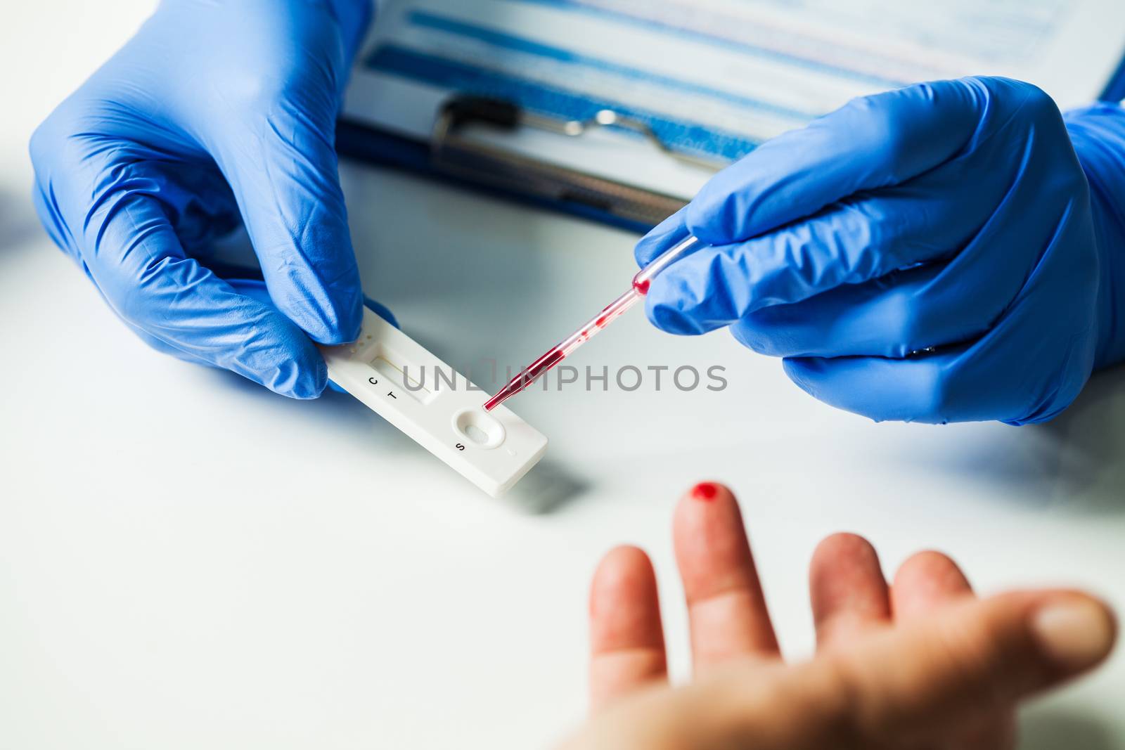 Coronavirus finger prick blood sample serological testing procedure by Plyushkin