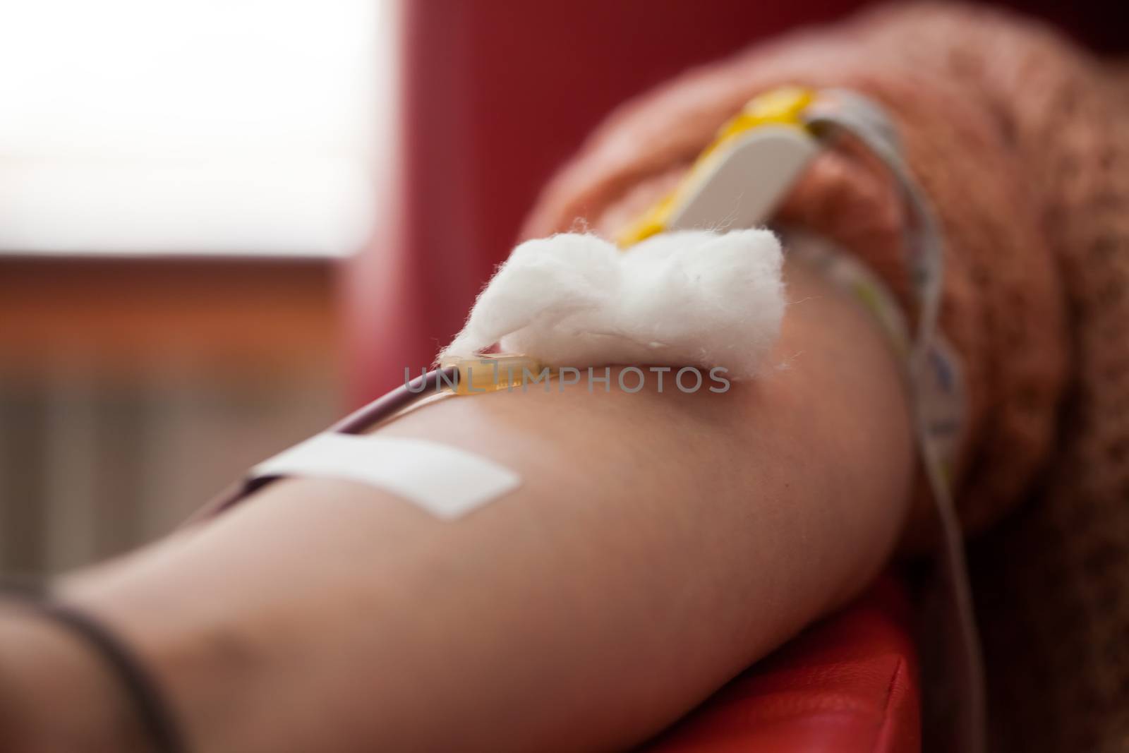 Closeup female caucasian donor hand donate PRP blood plasma,COVID-19 corona virus disease crisis,needle in vein detail,charity benevolence goodwill saving lives help those in need concept,NHS research