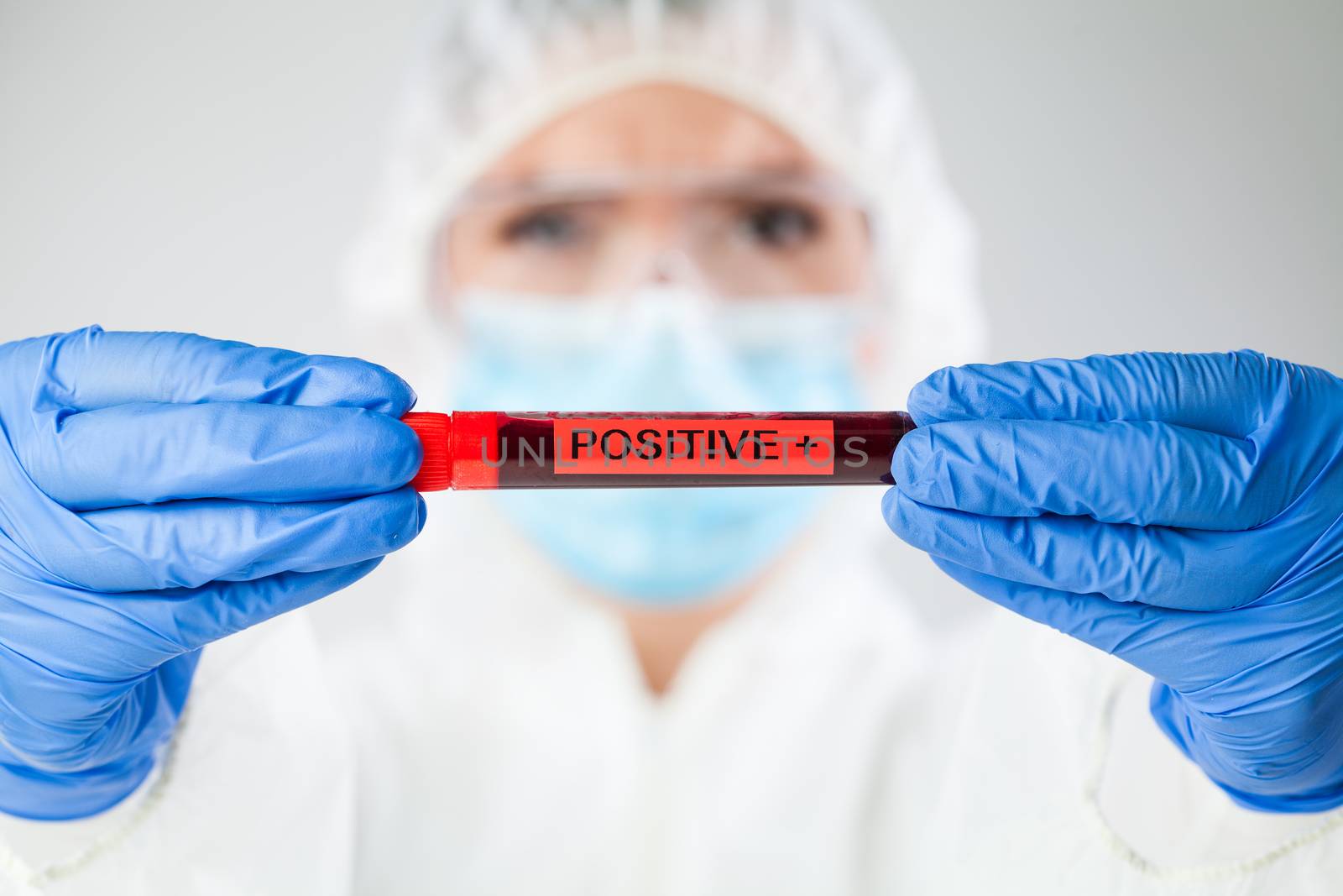 Medical technologist holding blood sample test tube POSITIVE  by Plyushkin