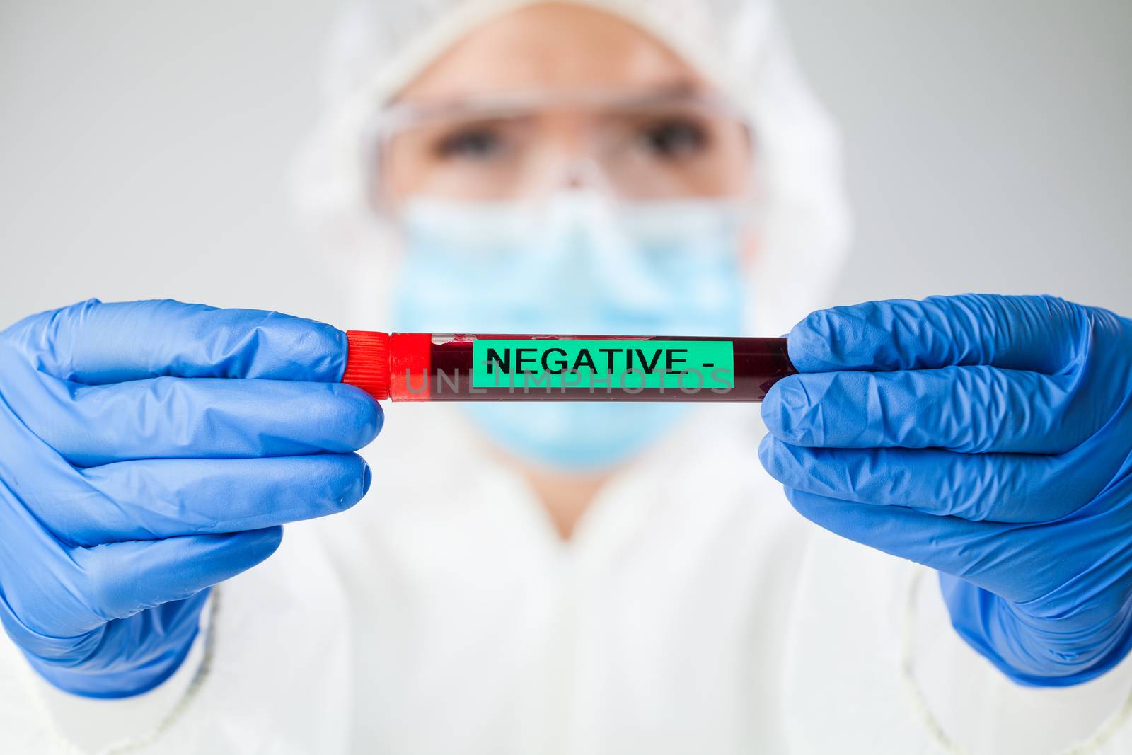 Medical technologist holding blood sample test tube NEGATIVE by Plyushkin