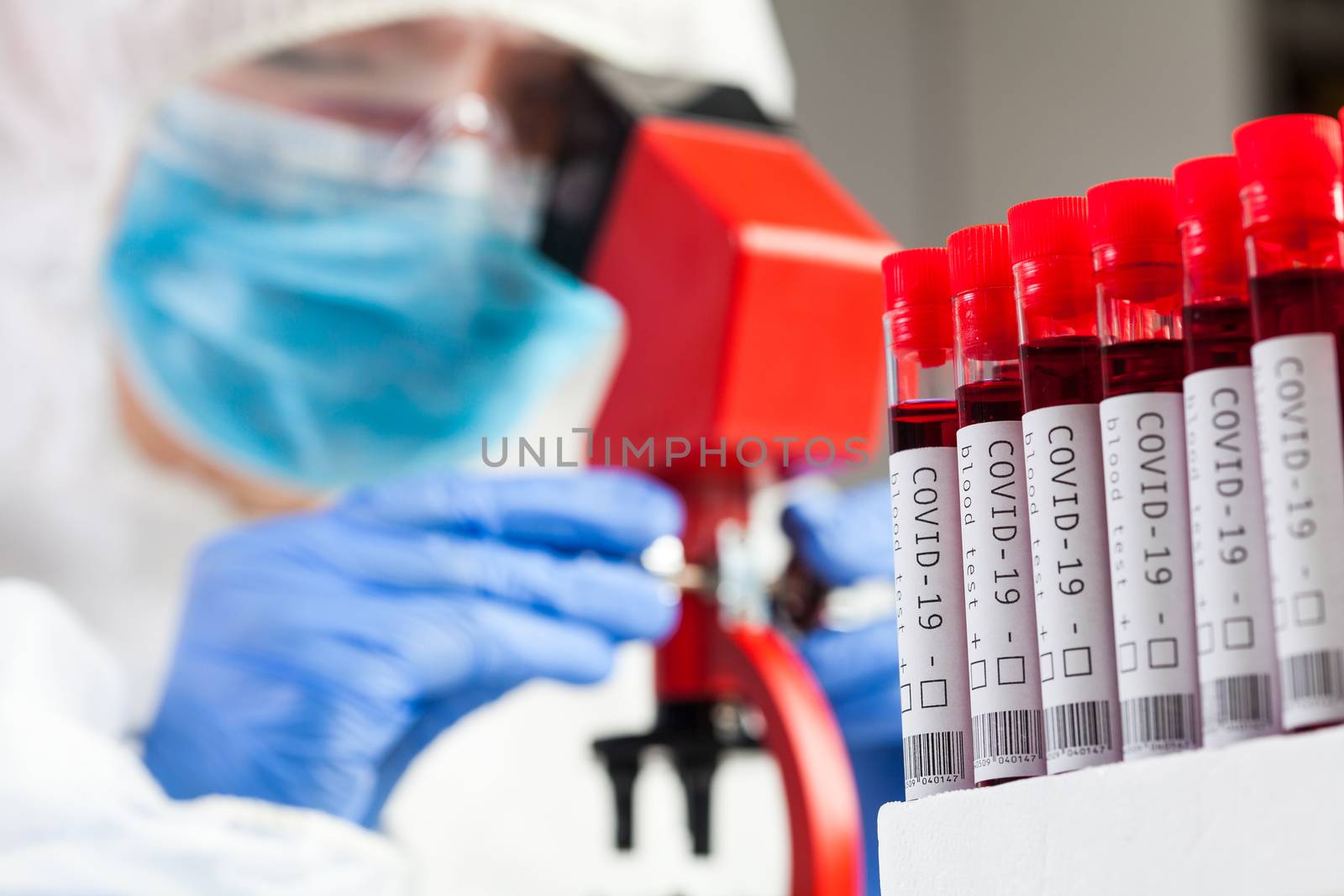 Medical technologist or lab scientist microscope examining Coronavirus patient test tube blood sample specimen, deadly COVID-19 respiratory virus disease global worldwide pandemic outbreak crisis