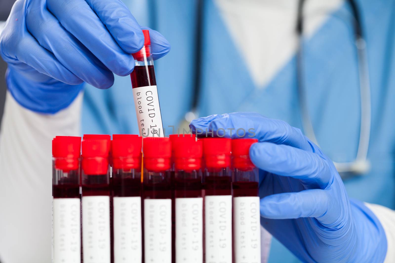 Doctor pulling out a red test tube with Coronavirus patient blood sample ready for laboratory examination,wearing blue gloves,global pandemic deadly COVID-19 corona virus disease illustration,WHO test