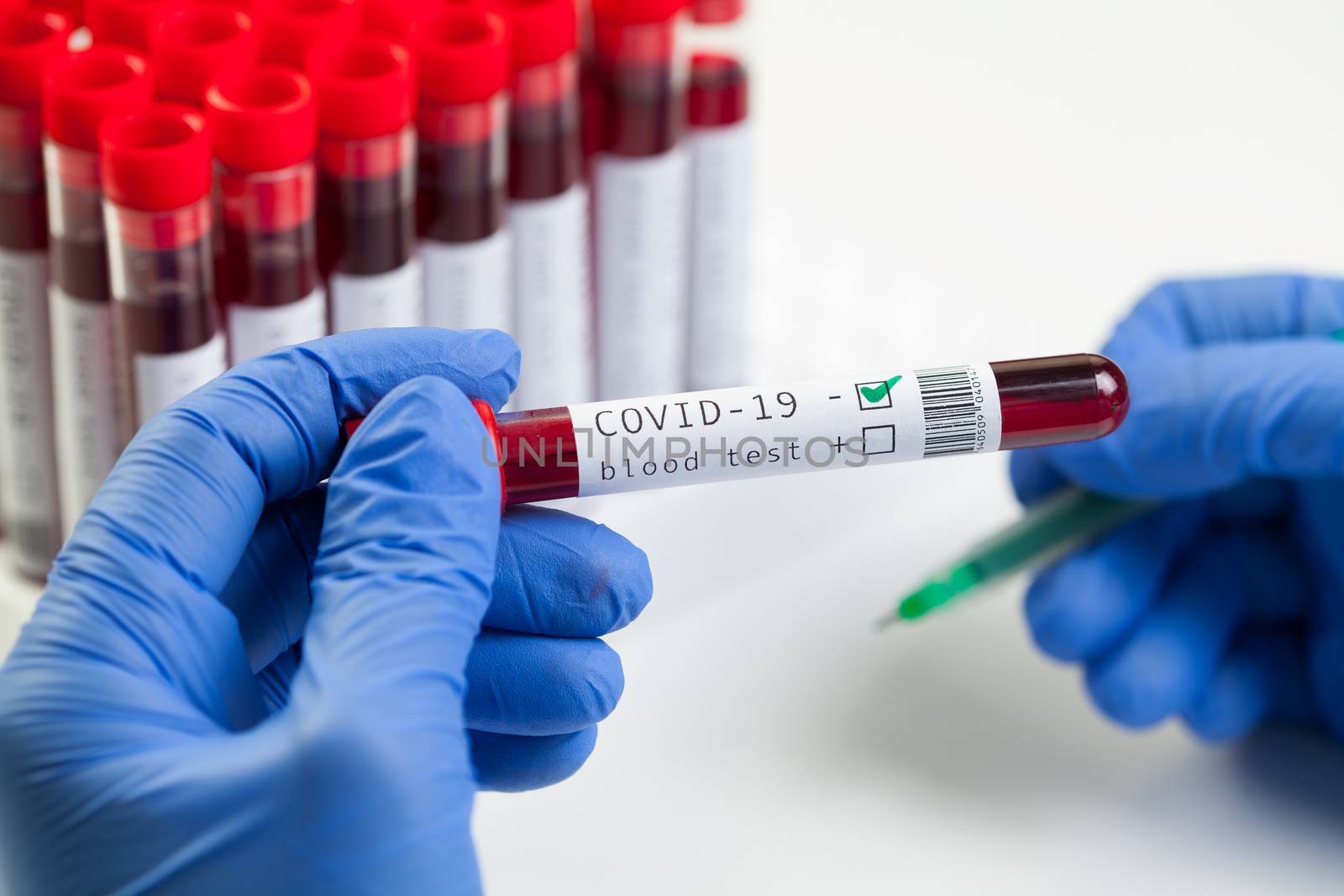 Doctor or lab scientist labelling a test tube with Coronavirus patient blood sample,NEGATIVE Covid-19 test results, deadly corona virus disease,global pandemic crisis,WHO hematology testing procedure