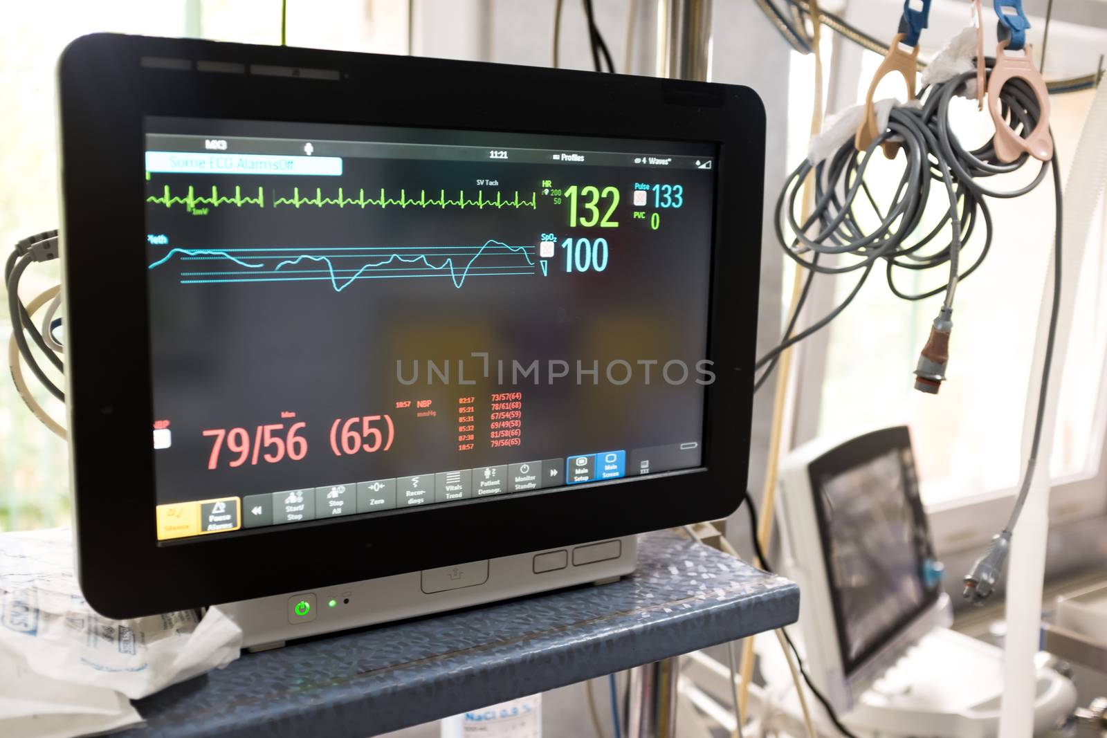 Electrocardiograph (ECG or EKG) unit in a hospital emergency room, black monitor screen showing heart rate & pulse,COVID-19 coronavirus USA pandemic healthcare crisis,high death toll & mortality rate
