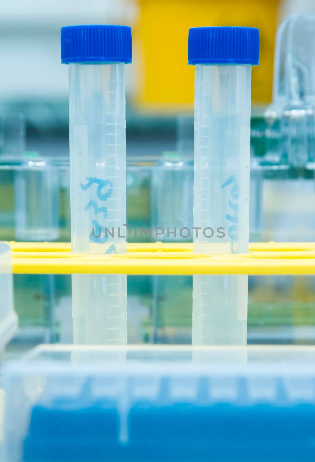Close-up of plastic test tubes with a blue lid in a tripod. Laboratory utensils. In the scientific laboratory. Preparation for the experiment.